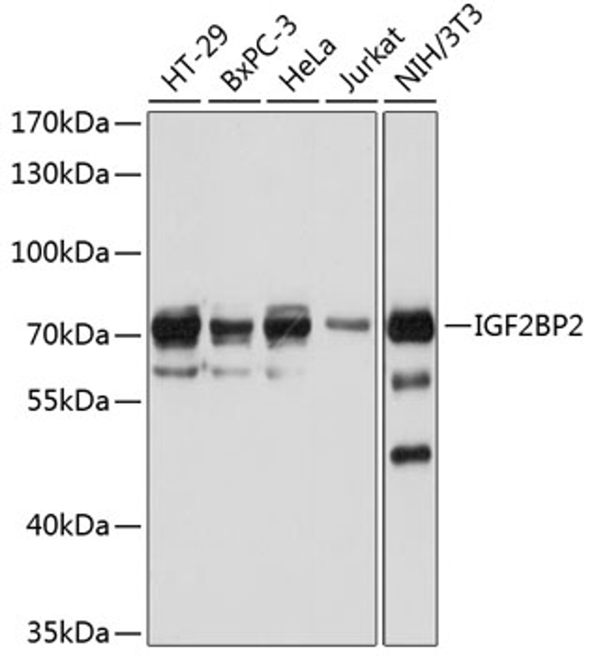 Western blot analysis of extracts of various cell lines, using IGF2BP2 antibody (18-082) at 1:1000 dilution.<br/>Secondary antibody: HRP Goat Anti-Rabbit IgG (H+L) at 1:10000 dilution.<br/>Lysates/proteins: 25ug per lane.<br/>Blocking buffer: 3% nonfat dry milk in TBST.<br/>Detection: ECL Basic Kit.<br/>Exposure time: 30s.