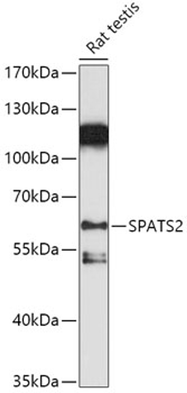 Western blot analysis of extracts of Rat testis, using SPATS2 antibody (18-091) at 1:1000 dilution.<br/>Secondary antibody: HRP Goat Anti-Rabbit IgG (H+L) at 1:10000 dilution.<br/>Lysates/proteins: 25ug per lane.<br/>Blocking buffer: 3% nonfat dry milk in TBST.<br/>Detection: ECL Basic Kit.<br/>Exposure time: 300s.