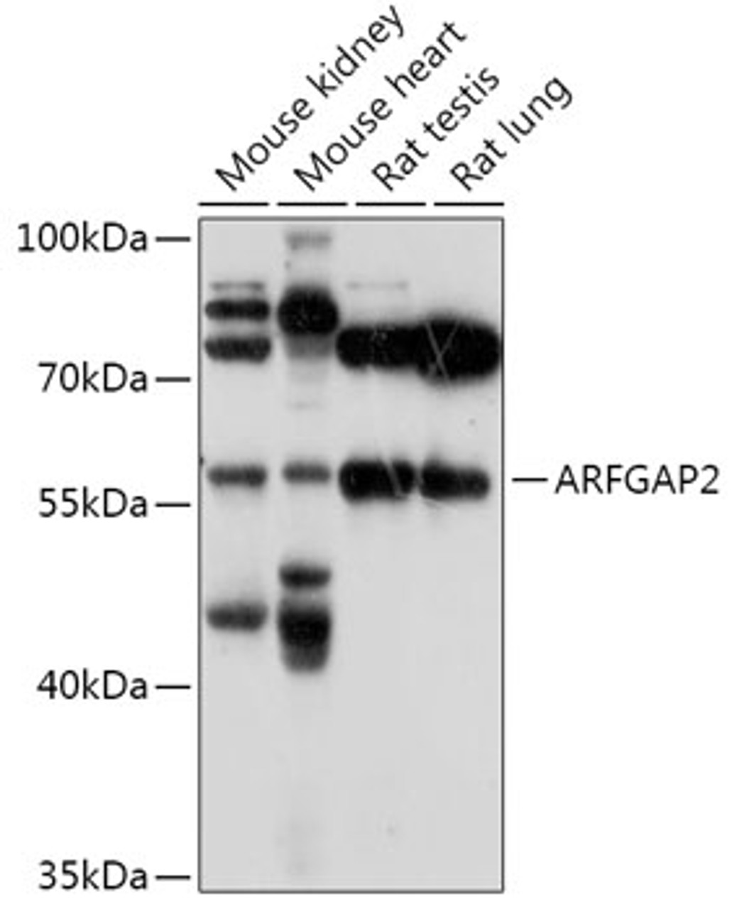 Western blot analysis of extracts of various cell lines, using ARFGAP2 antibody (18-100) at 1:1000 dilution.<br/>Secondary antibody: HRP Goat Anti-Rabbit IgG (H+L) at 1:10000 dilution.<br/>Lysates/proteins: 25ug per lane.<br/>Blocking buffer: 3% nonfat dry milk in TBST.<br/>Detection: ECL Basic Kit.<br/>Exposure time: 90s.