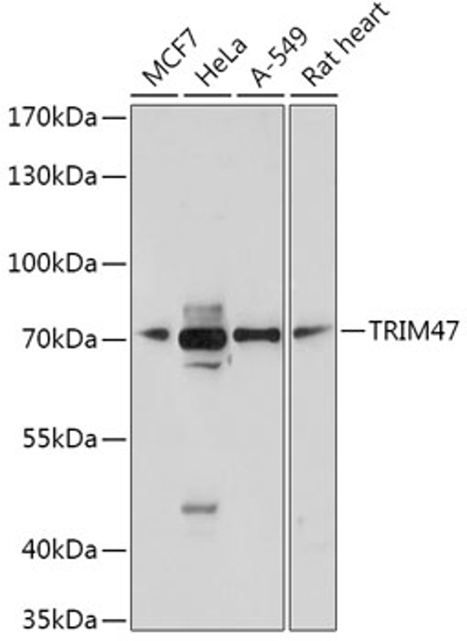 Western blot analysis of extracts of various cell lines, using TRIM47 antibody (18-108) at 1:1000 dilution.<br/>Secondary antibody: HRP Goat Anti-Rabbit IgG (H+L) at 1:10000 dilution.<br/>Lysates/proteins: 25ug per lane.<br/>Blocking buffer: 3% nonfat dry milk in TBST.<br/>Detection: ECL Basic Kit.<br/>Exposure time: 30s.