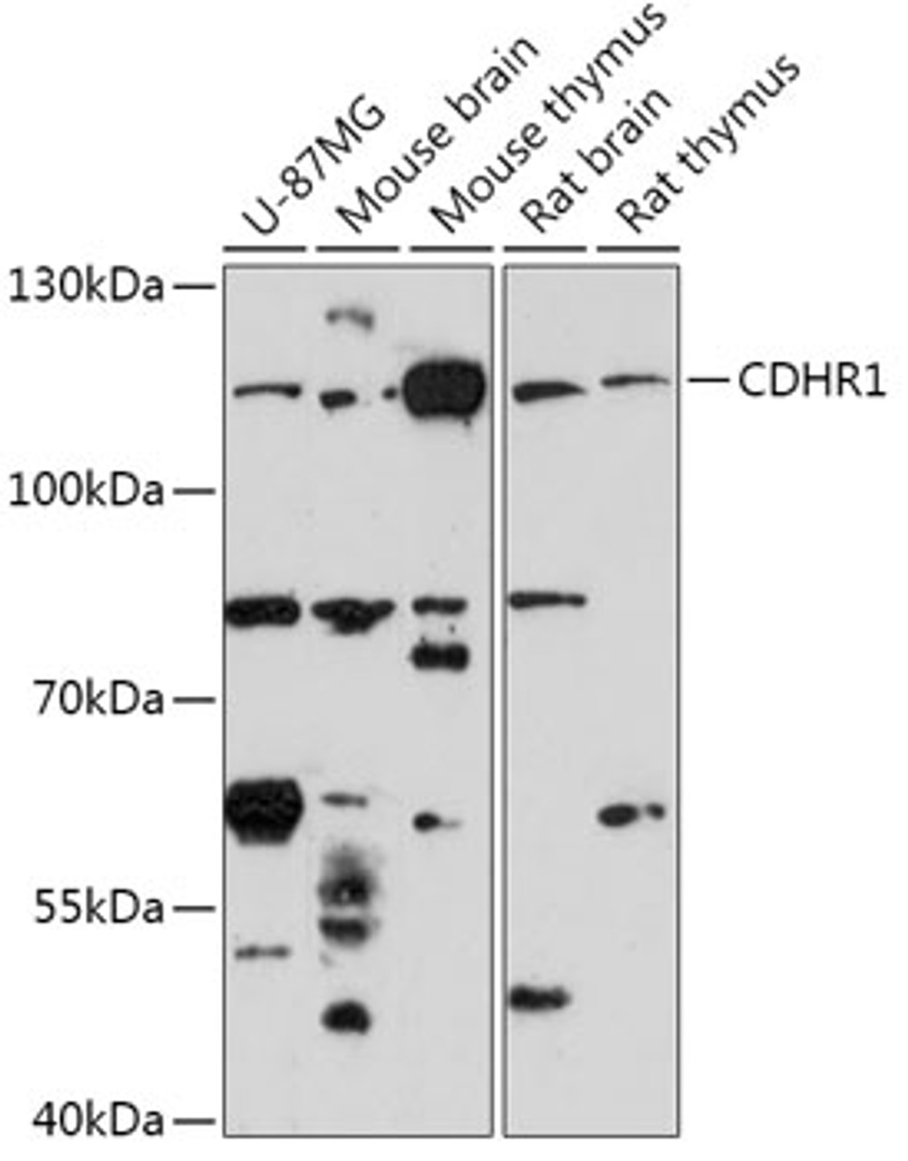 Western blot analysis of extracts of various cell lines, using CDHR1 antibody (18-111) at 1:1000 dilution.<br/>Secondary antibody: HRP Goat Anti-Rabbit IgG (H+L) at 1:10000 dilution.<br/>Lysates/proteins: 25ug per lane.<br/>Blocking buffer: 3% nonfat dry milk in TBST.<br/>Detection: ECL Enhanced Kit.<br/>Exposure time: 3min.