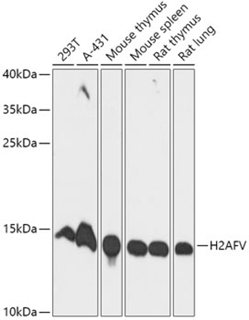 Western blot analysis of extracts of various cell lines, using H2AFV antibody (18-114) at 1:1000 dilution.<br/>Secondary antibody: HRP Goat Anti-Rabbit IgG (H+L) at 1:10000 dilution.<br/>Lysates/proteins: 25ug per lane.<br/>Blocking buffer: 3% nonfat dry milk in TBST.<br/>Detection: ECL Basic Kit.<br/>Exposure time: 90s.