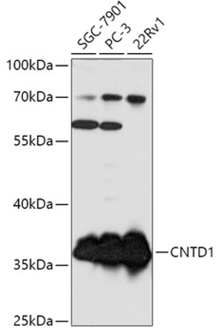 Western blot analysis of extracts of various cell lines, using CNTD1 antibody (18-118) at 1:1000 dilution.<br/>Secondary antibody: HRP Goat Anti-Rabbit IgG (H+L) at 1:10000 dilution.<br/>Lysates/proteins: 25ug per lane.<br/>Blocking buffer: 3% nonfat dry milk in TBST.<br/>Detection: ECL Basic Kit.<br/>Exposure time: 1s.