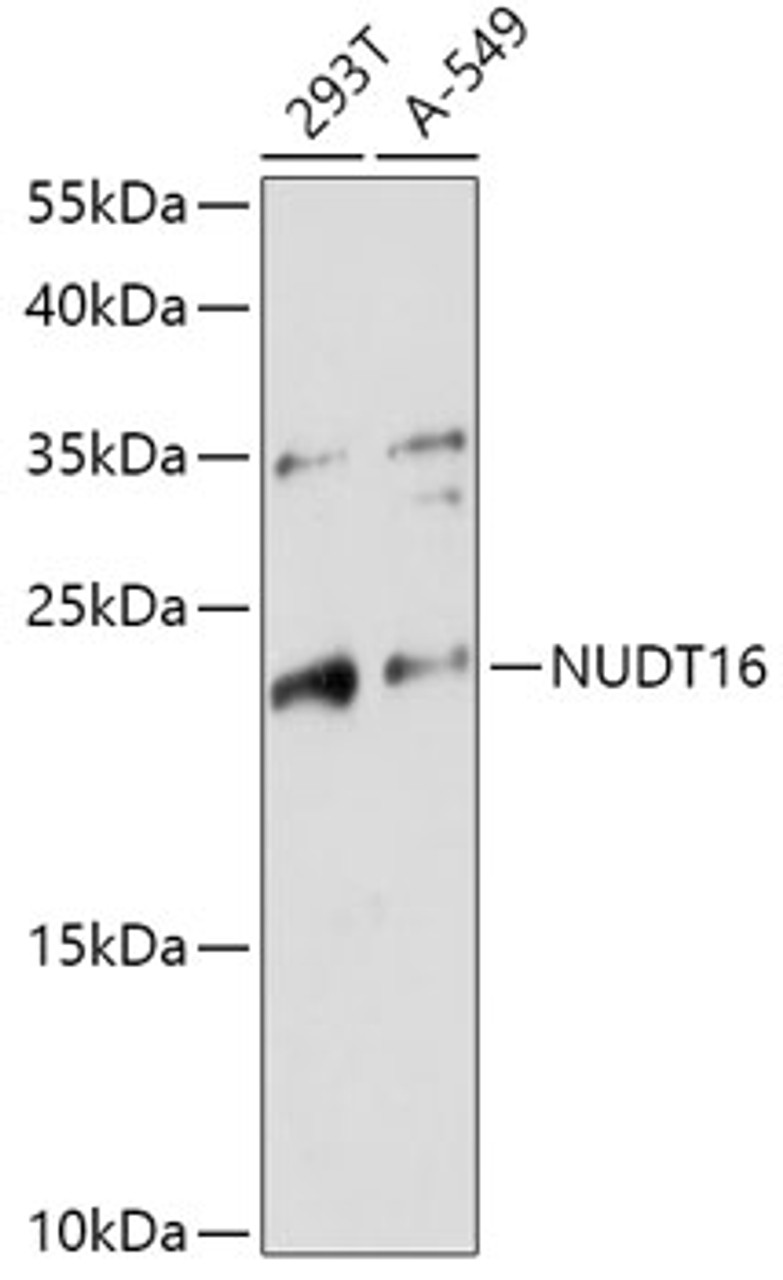 Western blot analysis of extracts of various cell lines, using NUDT16 antibody (18-122) at 1:1000 dilution.<br/>Secondary antibody: HRP Goat Anti-Rabbit IgG (H+L) at 1:10000 dilution.<br/>Lysates/proteins: 25ug per lane.<br/>Blocking buffer: 3% nonfat dry milk in TBST.<br/>Detection: ECL Basic Kit.<br/>Exposure time: 180s.