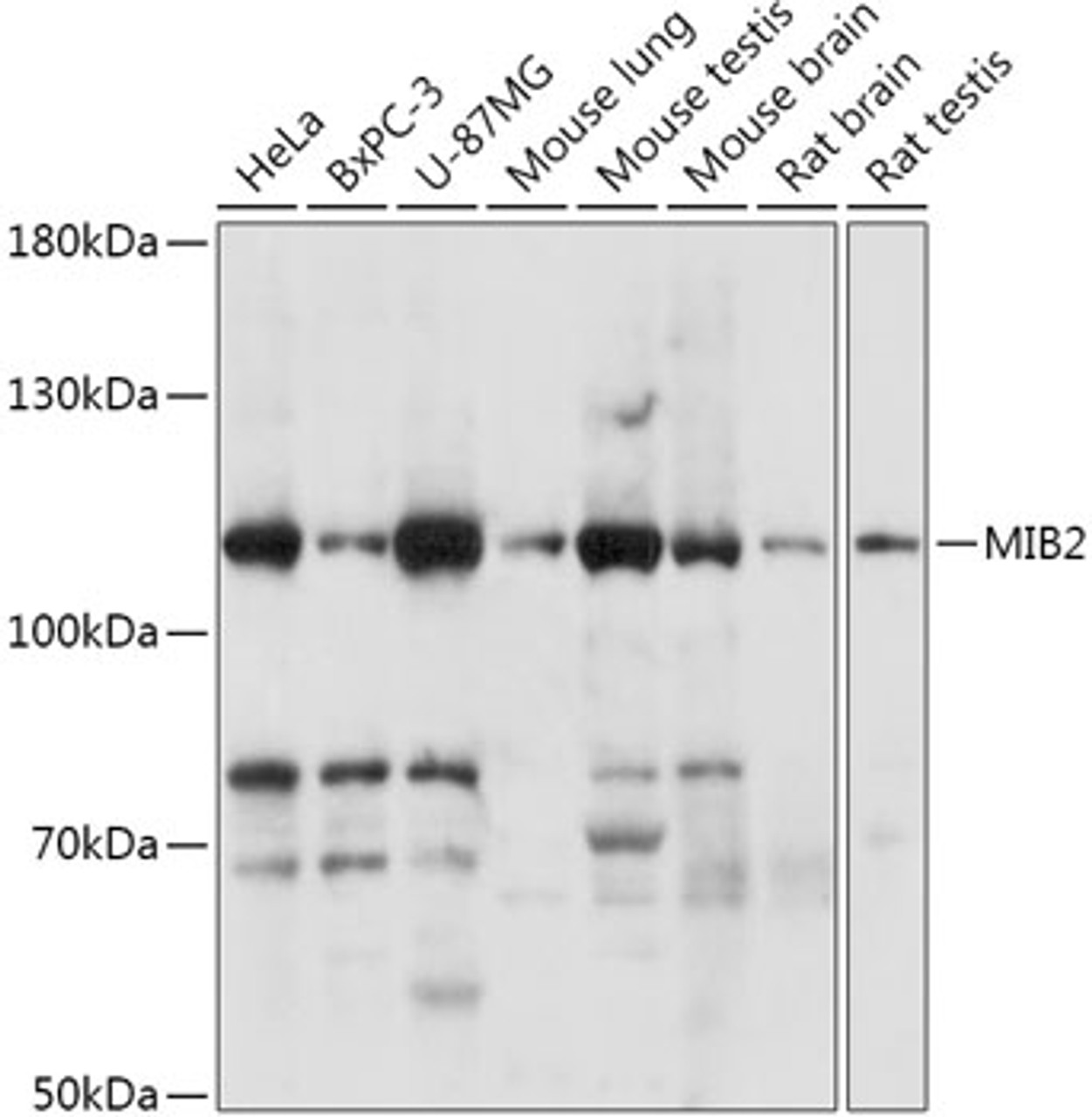 Western blot analysis of extracts of various cell lines, using MIB2 antibody (18-124) at 1:1000 dilution.<br/>Secondary antibody: HRP Goat Anti-Rabbit IgG (H+L) at 1:10000 dilution.<br/>Lysates/proteins: 25ug per lane.<br/>Blocking buffer: 3% nonfat dry milk in TBST.<br/>Detection: ECL Basic Kit.<br/>Exposure time: 60s.
