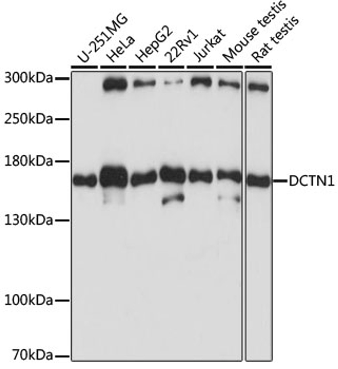 Western blot analysis of extracts of various cell lines, using DCTN1 antibody (18-125) at 1:1000 dilution.<br/>Secondary antibody: HRP Goat Anti-Rabbit IgG (H+L) at 1:10000 dilution.<br/>Lysates/proteins: 25ug per lane.<br/>Blocking buffer: 3% nonfat dry milk in TBST.<br/>Detection: ECL Basic Kit.<br/>Exposure time: 10s.