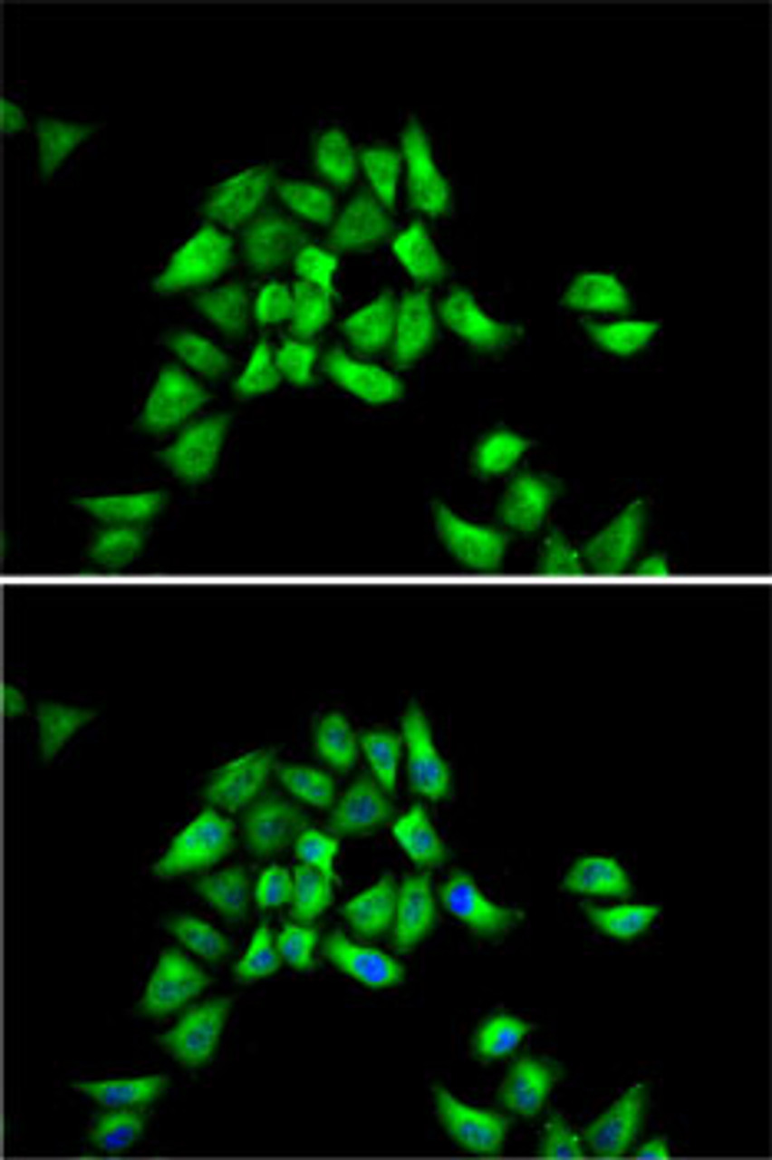 Immunofluorescence analysis of HeLa cells using DCTN1 antibody (18-125) . Blue: DAPI for nuclear staining.