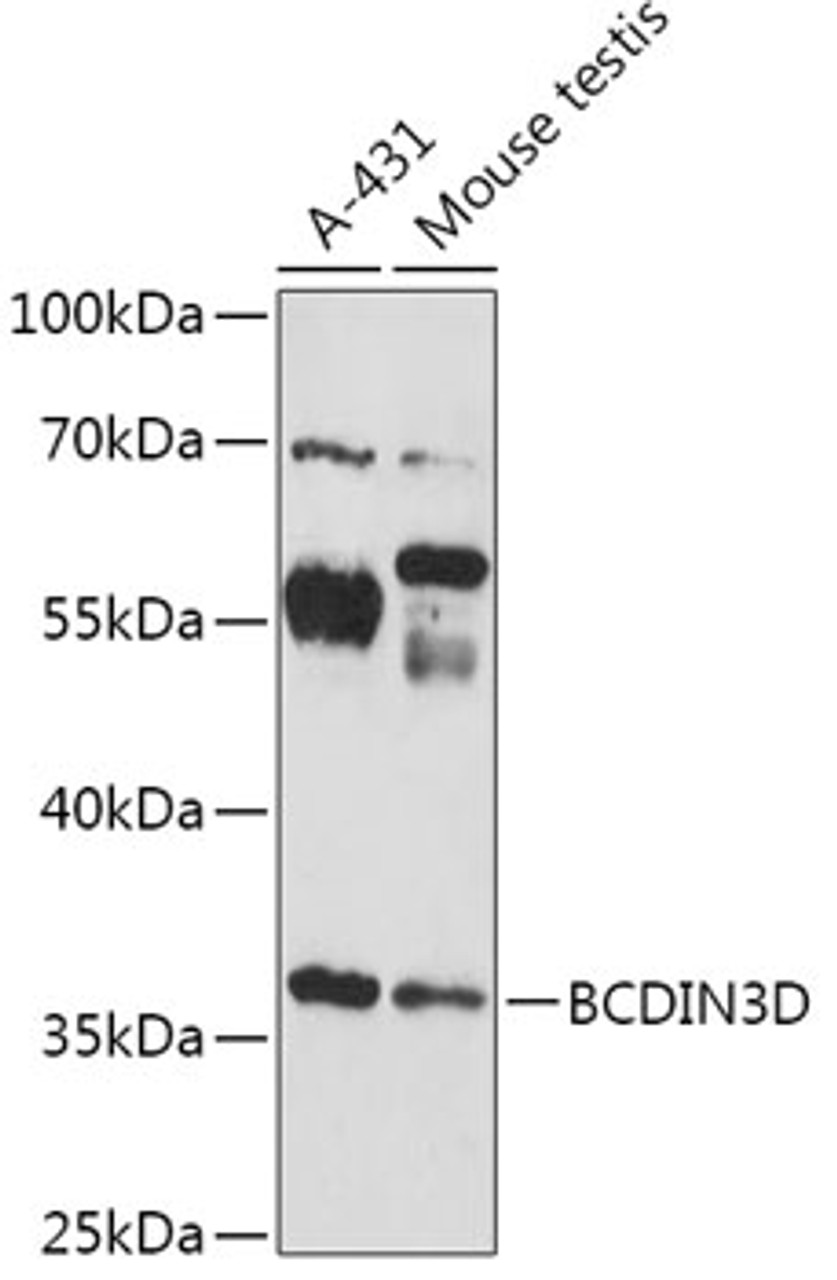 Western blot analysis of extracts of various cell lines, using BCDIN3D antibody (18-126) at 1:1000 dilution.<br/>Secondary antibody: HRP Goat Anti-Rabbit IgG (H+L) at 1:10000 dilution.<br/>Lysates/proteins: 25ug per lane.<br/>Blocking buffer: 3% nonfat dry milk in TBST.<br/>Detection: ECL Enhanced Kit.<br/>Exposure time: 180s.