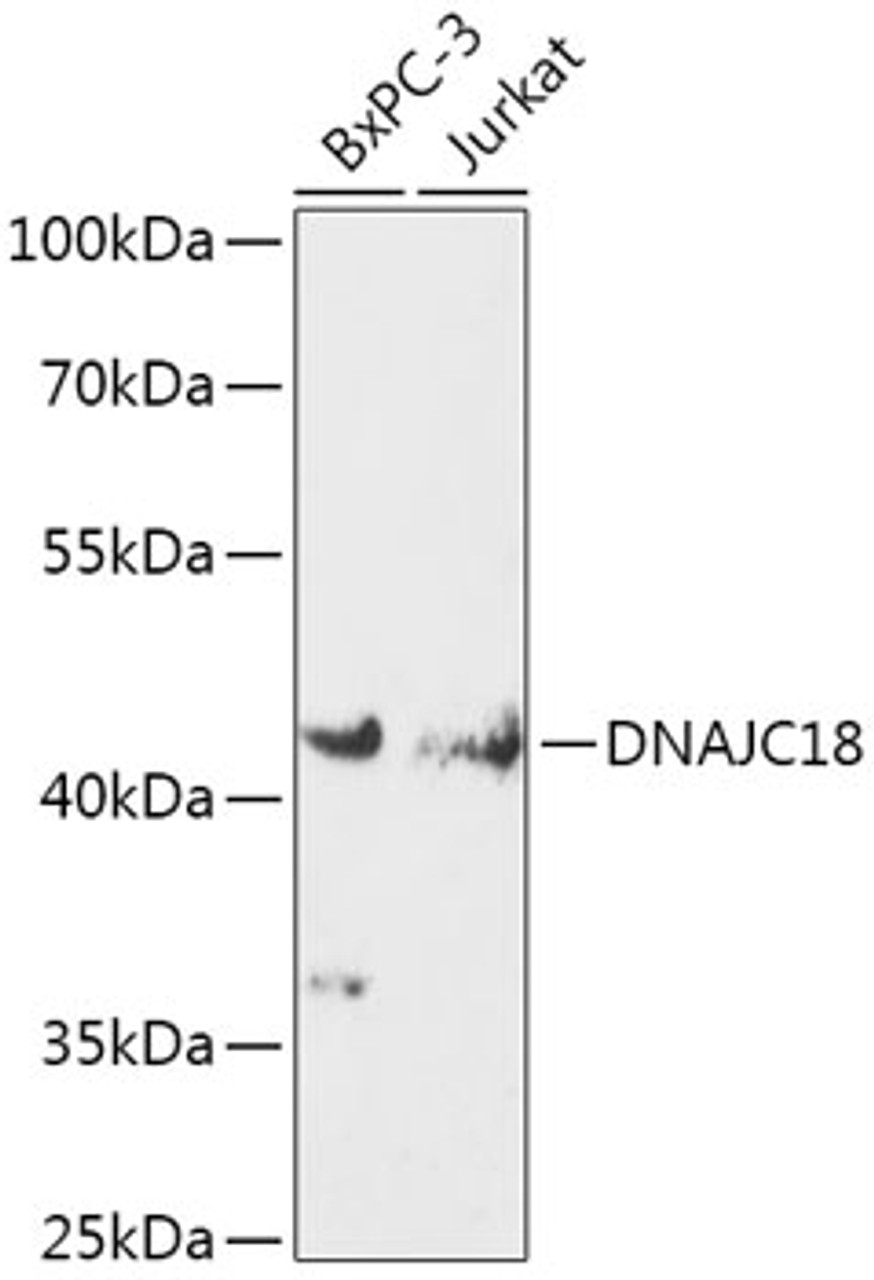 Western blot analysis of extracts of various cell lines, using DNAJC18 antibody (18-129) at 1:1000 dilution.<br/>Secondary antibody: HRP Goat Anti-Rabbit IgG (H+L) at 1:10000 dilution.<br/>Lysates/proteins: 25ug per lane.<br/>Blocking buffer: 3% nonfat dry milk in TBST.<br/>Detection: ECL Enhanced Kit.<br/>Exposure time: 300s.