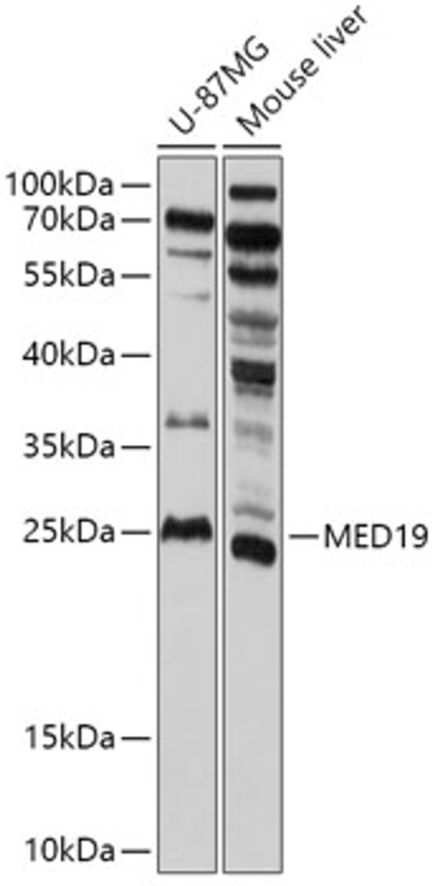 Western blot analysis of extracts of various cell lines, using MED19 antibody (18-130) at 1:1000 dilution.<br/>Secondary antibody: HRP Goat Anti-Rabbit IgG (H+L) at 1:10000 dilution.<br/>Lysates/proteins: 25ug per lane.<br/>Blocking buffer: 3% nonfat dry milk in TBST.<br/>Detection: ECL Basic Kit.<br/>Exposure time: 90s.