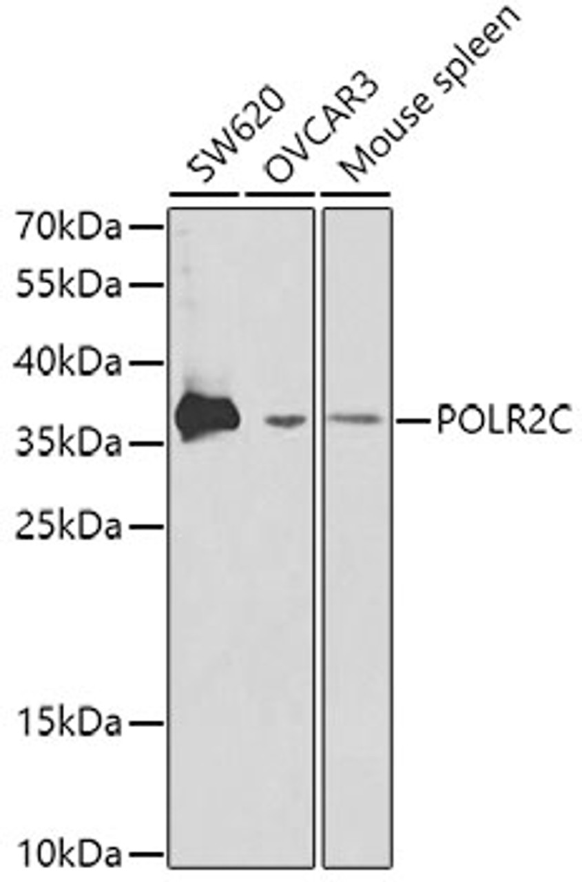 Western blot analysis of extracts of various cell lines, using POLR2C antibody (18-131) at 1:1000 dilution.<br/>Secondary antibody: HRP Goat Anti-Rabbit IgG (H+L) at 1:10000 dilution.<br/>Lysates/proteins: 25ug per lane.<br/>Blocking buffer: 3% nonfat dry milk in TBST.