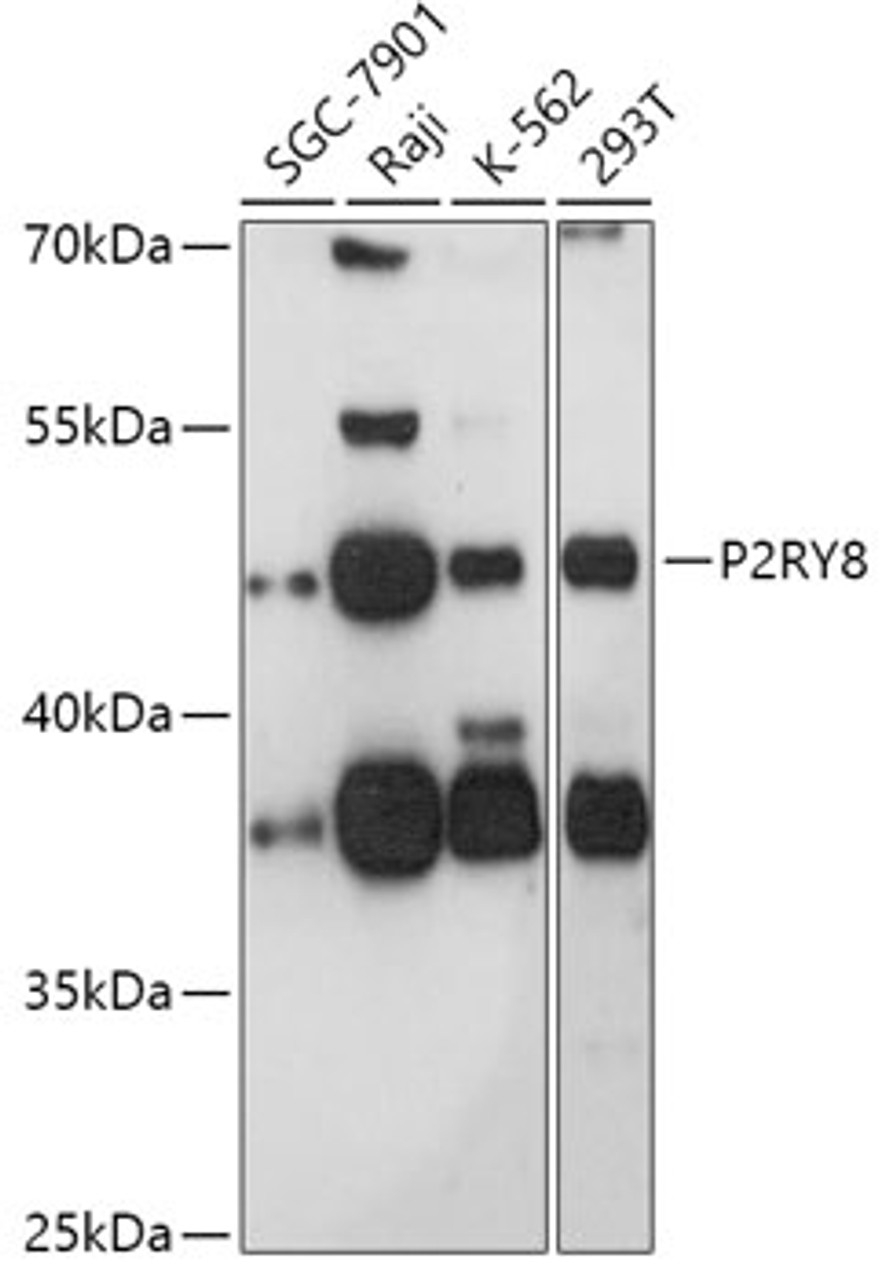 Western blot analysis of extracts of various cell lines, using P2RY8 antibody (18-132) at 1:1000 dilution.<br/>Secondary antibody: HRP Goat Anti-Rabbit IgG (H+L) at 1:10000 dilution.<br/>Lysates/proteins: 25ug per lane.<br/>Blocking buffer: 3% nonfat dry milk in TBST.<br/>Detection: ECL Basic Kit.<br/>Exposure time: 90s.