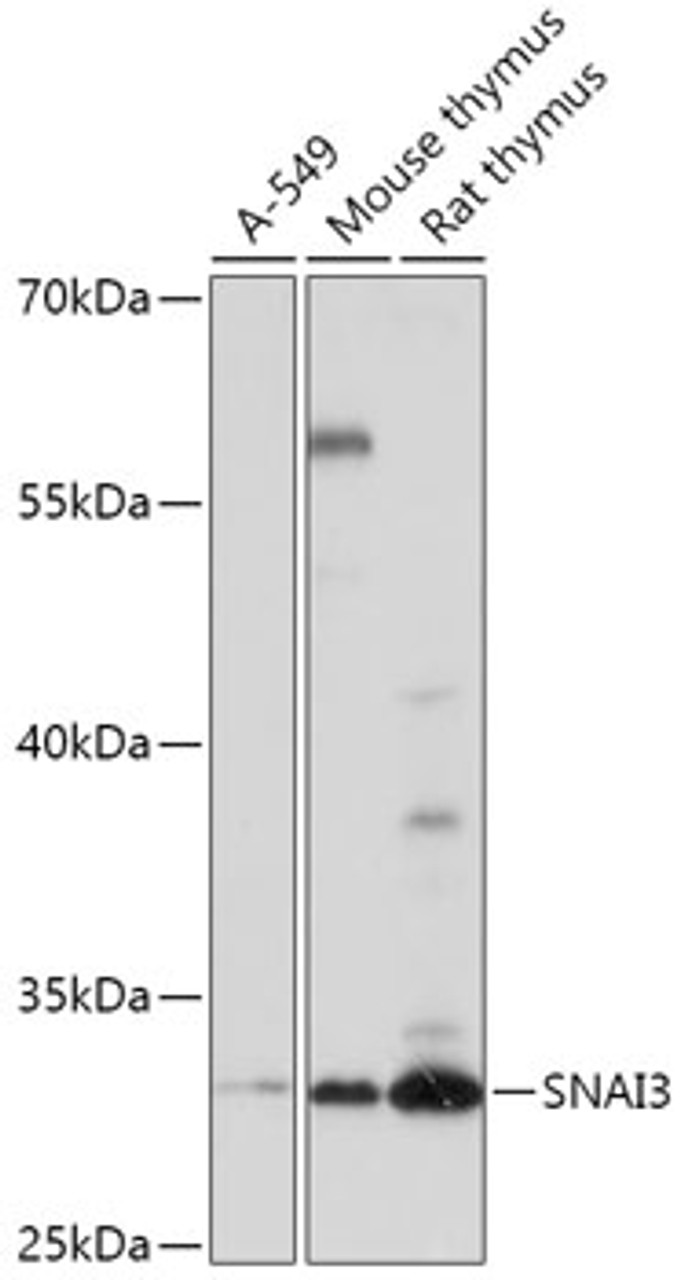 Western blot analysis of extracts of various cell lines, using SNAI3 antibody (18-135) at 1:1000 dilution.<br/>Secondary antibody: HRP Goat Anti-Rabbit IgG (H+L) at 1:10000 dilution.<br/>Lysates/proteins: 25ug per lane.<br/>Blocking buffer: 3% nonfat dry milk in TBST.<br/>Detection: ECL Basic Kit.<br/>Exposure time: 90s.