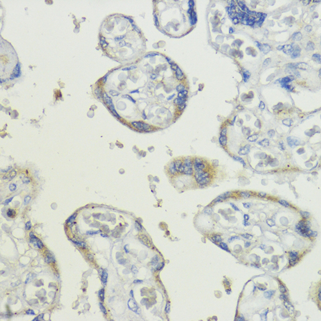 Immunohistochemistry of paraffin-embedded human placenta using BMPR1B antibody (18-138) at dilution of 1:200 (40x lens) .