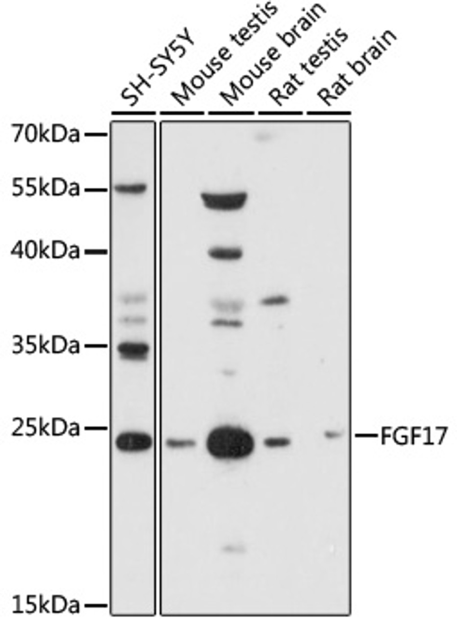 Western blot analysis of extracts of various cell lines, using FGF17 antibody (18-143) at 1:1000 dilution.<br/>Secondary antibody: HRP Goat Anti-Rabbit IgG (H+L) at 1:10000 dilution.<br/>Lysates/proteins: 25ug per lane.<br/>Blocking buffer: 3% nonfat dry milk in TBST.<br/>Detection: ECL Basic Kit.<br/>Exposure time: 60s.