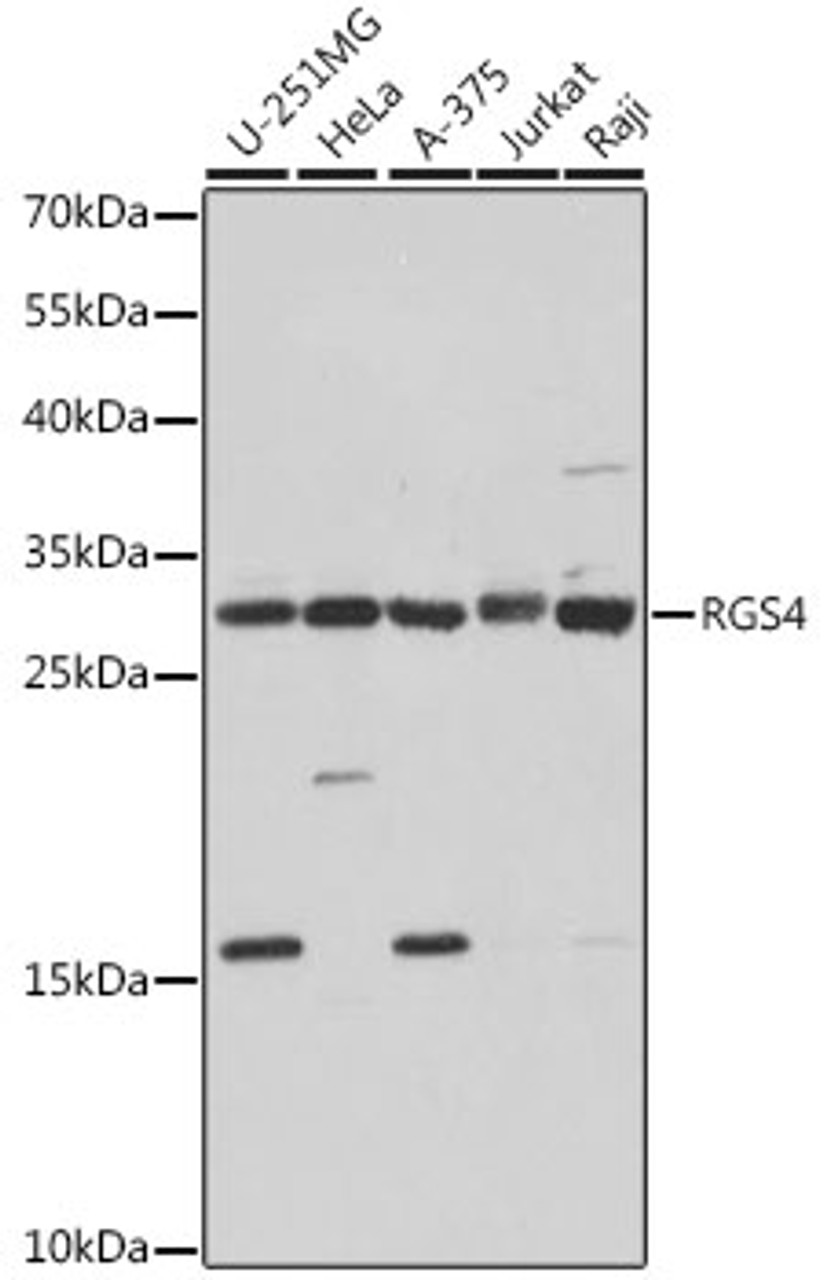 Western blot analysis of extracts of various cell lines, using RGS4 antibody (18-144) at 1:1000 dilution.<br/>Secondary antibody: HRP Goat Anti-Rabbit IgG (H+L) at 1:10000 dilution.<br/>Lysates/proteins: 25ug per lane.<br/>Blocking buffer: 3% nonfat dry milk in TBST.<br/>Detection: ECL Basic Kit.<br/>Exposure time: 1s.
