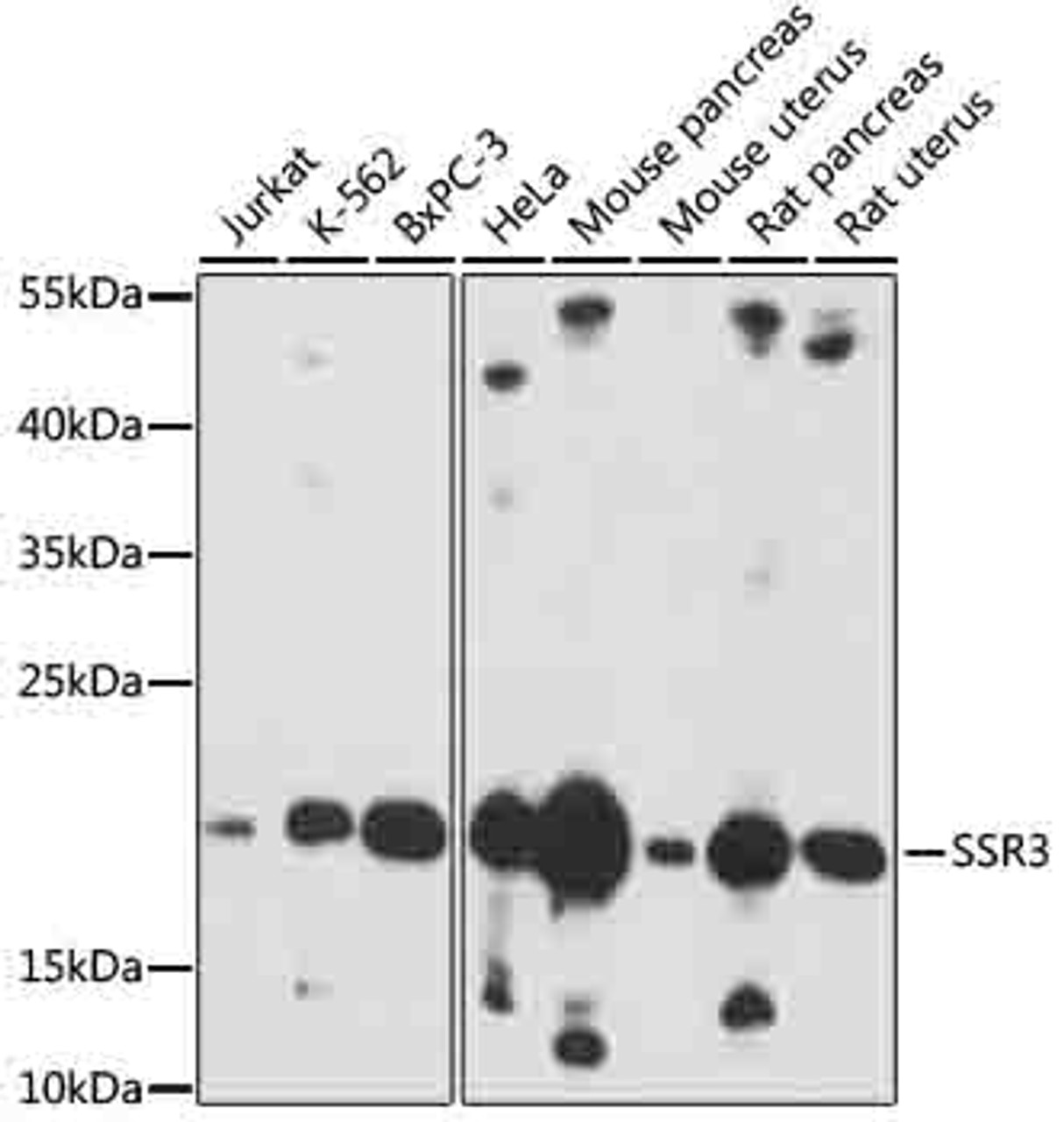 Western blot analysis of extracts of various cells, using SSR3 antibody (18-146) at 1:1000 dilution.<br/>Secondary antibody: HRP Goat Anti-Rabbit IgG (H+L) at 1:10000 dilution.<br/>Lysates/proteins: 25ug per lane.<br/>Blocking buffer: 3% nonfat dry milk in TBST.<br/>Detection: ECL Basic Kit.<br/>Exposure time: 30s.