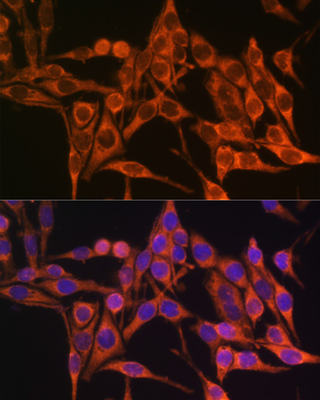 Immunofluorescence analysis of HeLa cells using MT-ATP8 antibody (18-154) at dilution of 1:100. Blue: DAPI for nuclear staining.