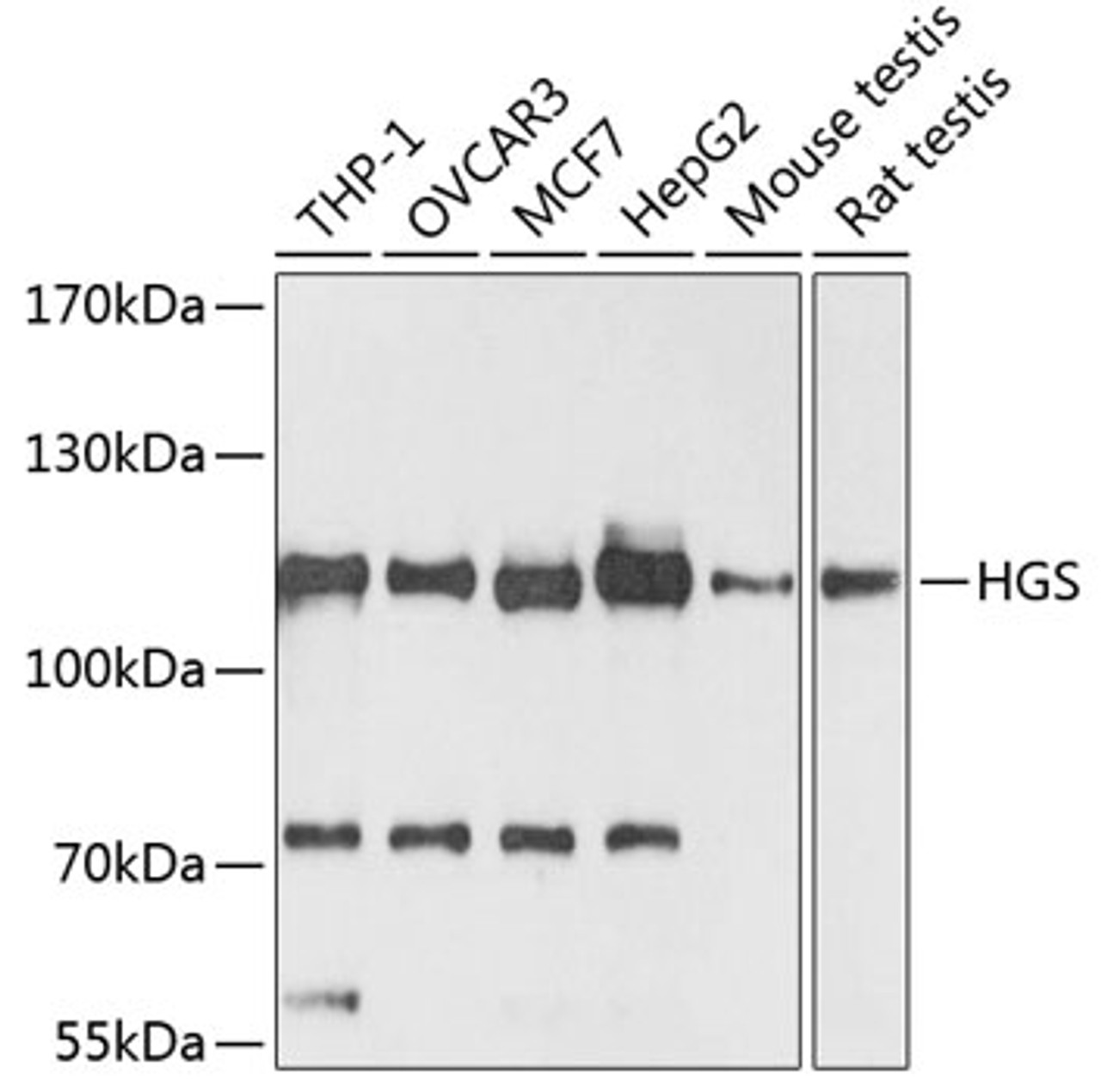 Western blot analysis of extracts of various cell lines, using HGS antibody (18-156) at 1:3000 dilution.<br/>Secondary antibody: HRP Goat Anti-Rabbit IgG (H+L) at 1:10000 dilution.<br/>Lysates/proteins: 25ug per lane.<br/>Blocking buffer: 3% nonfat dry milk in TBST.<br/>Detection: ECL Basic Kit.<br/>Exposure time: 90s.