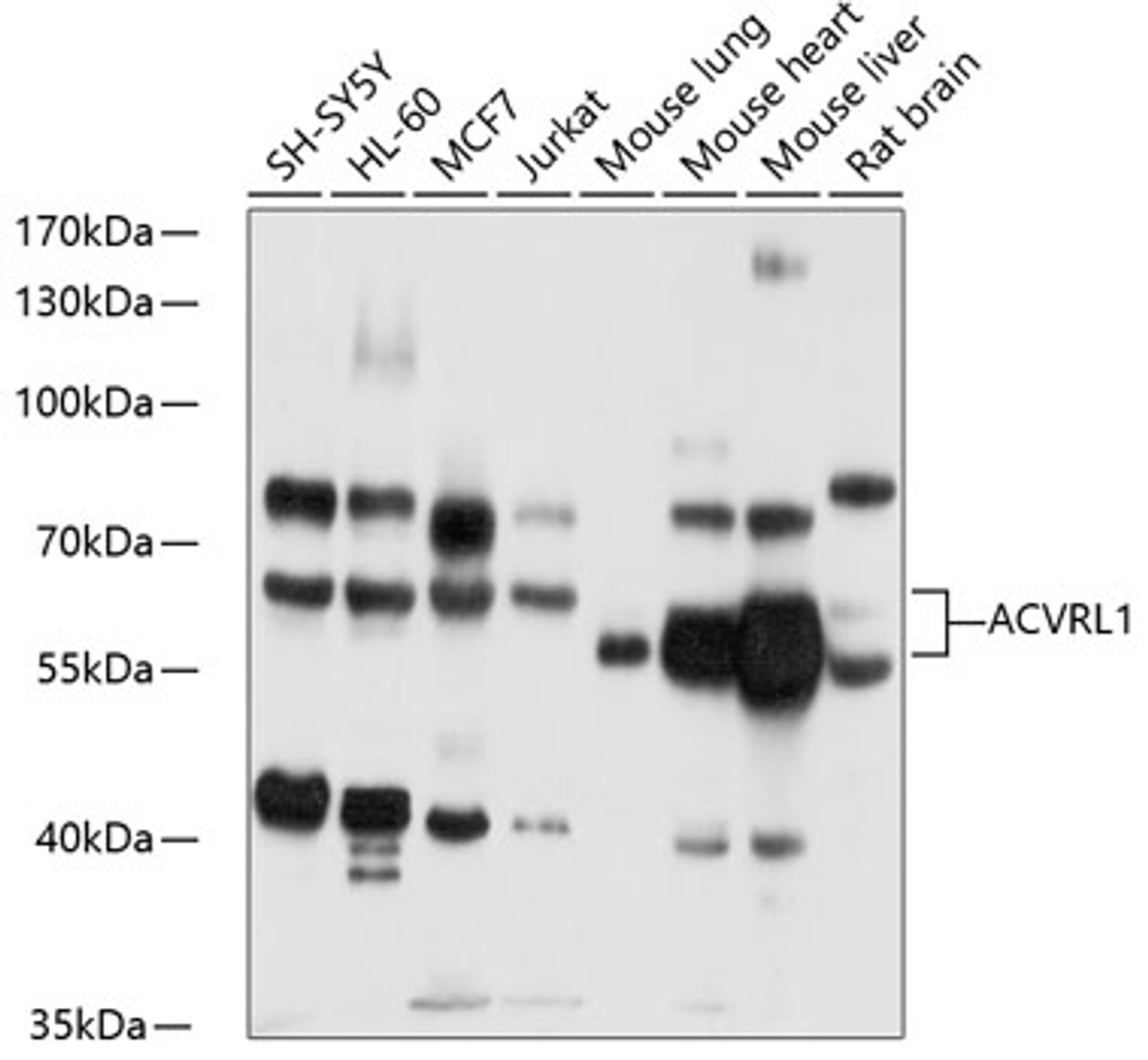 Western blot analysis of extracts of various cell lines, using ACVRL1 antibody (18-157) at 1:1000 dilution.<br/>Secondary antibody: HRP Goat Anti-Rabbit IgG (H+L) at 1:10000 dilution.<br/>Lysates/proteins: 25ug per lane.<br/>Blocking buffer: 3% nonfat dry milk in TBST.<br/>Detection: ECL Basic Kit.<br/>Exposure time: 30s.