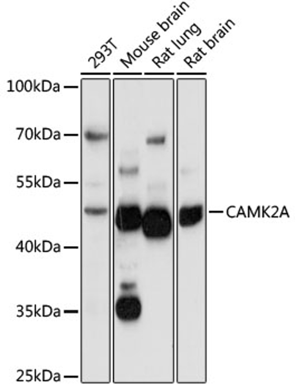 Western blot analysis of extracts of various cell lines, using CAMK2A antibody (18-158) at 1:1000 dilution.<br/>Secondary antibody: HRP Goat Anti-Rabbit IgG (H+L) at 1:10000 dilution.<br/>Lysates/proteins: 25ug per lane.<br/>Blocking buffer: 3% nonfat dry milk in TBST.<br/>Detection: ECL Basic Kit.<br/>Exposure time: 60s.