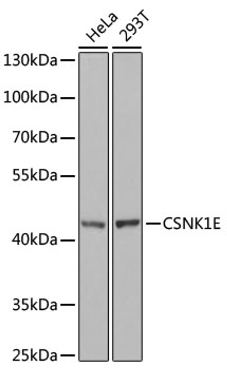 Western blot analysis of extracts of various cell lines, using CSNK1E antibody (18-170) at 1:1000 dilution.<br/>Secondary antibody: HRP Goat Anti-Rabbit IgG (H+L) at 1:10000 dilution.<br/>Lysates/proteins: 25ug per lane.<br/>Blocking buffer: 3% nonfat dry milk in TBST.<br/>Detection: ECL Basic Kit.<br/>Exposure time: 90s.