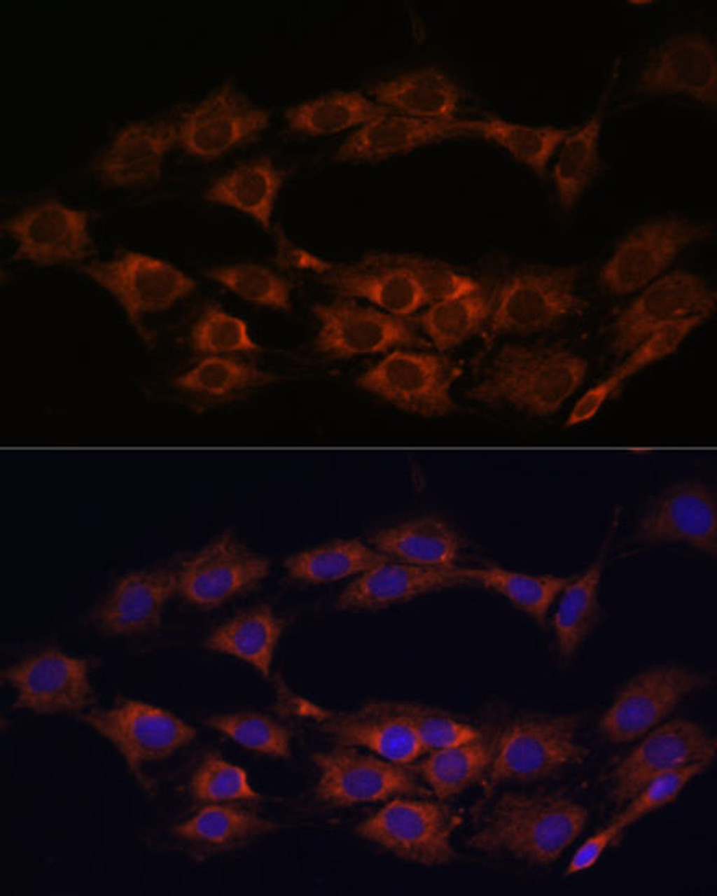 Immunofluorescence analysis of C6 cells using MT-ND1 Polyclonal Antibody (18-174) at dilution of 1:100 (40x lens) . Blue: DAPI for nuclear staining.