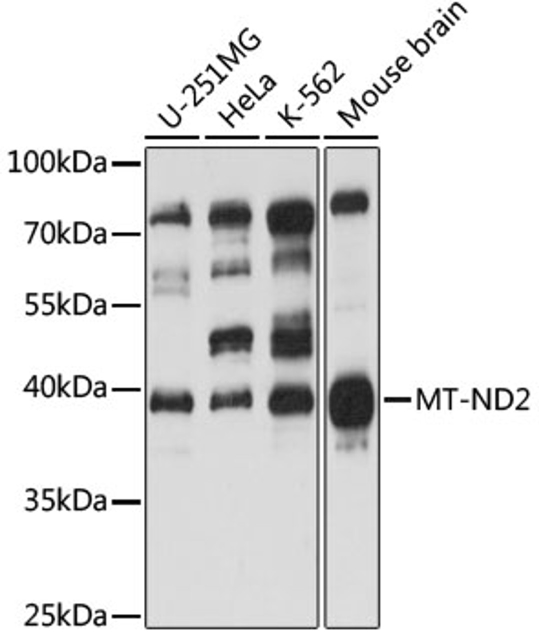 Western blot analysis of extracts of various cell lines, using MT-ND2 antibody (18-175) at 1:1000 dilution.<br/>Secondary antibody: HRP Goat Anti-Rabbit IgG (H+L) at 1:10000 dilution.<br/>Lysates/proteins: 25ug per lane.<br/>Blocking buffer: 3% nonfat dry milk in TBST.<br/>Detection: ECL Basic Kit.<br/>Exposure time: 10s.