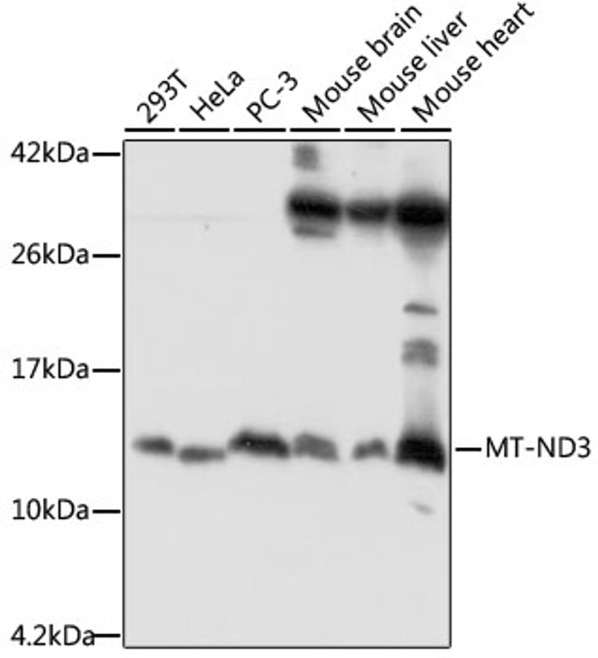 Western blot analysis of extracts of various cell lines, using MT-ND3 antibody (18-176) at 1:1000 dilution.<br/>Secondary antibody: HRP Goat Anti-Rabbit IgG (H+L) at 1:10000 dilution.<br/>Lysates/proteins: 25ug per lane.<br/>Blocking buffer: 3% nonfat dry milk in TBST.<br/>Detection: ECL Basic Kit.<br/>Exposure time: 90s.