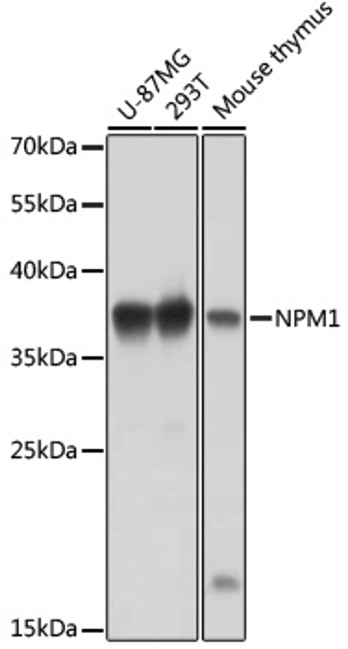 Western blot analysis of extracts of various cell lines, using NPM1 antibody (18-178) at 1:1000 dilution.<br/>Secondary antibody: HRP Goat Anti-Rabbit IgG (H+L) at 1:10000 dilution.<br/>Lysates/proteins: 25ug per lane.<br/>Blocking buffer: 3% nonfat dry milk in TBST.<br/>Detection: ECL Basic Kit.<br/>Exposure time: 3min.