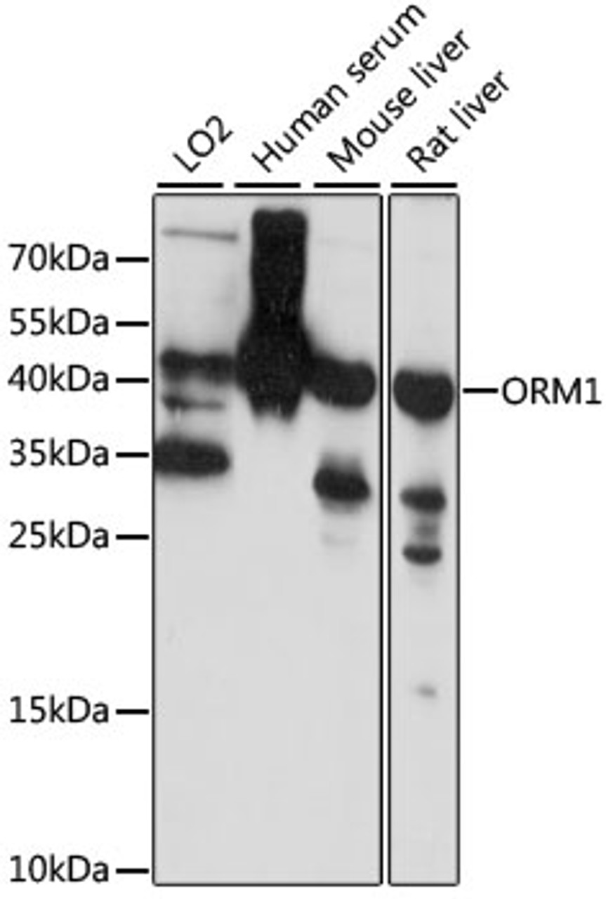 Western blot analysis of extracts of various cell lines, using ORM1 antibody (18-180) at 1:1000 dilution.<br/>Secondary antibody: HRP Goat Anti-Rabbit IgG (H+L) at 1:10000 dilution.<br/>Lysates/proteins: 25ug per lane.<br/>Blocking buffer: 3% nonfat dry milk in TBST.<br/>Detection: ECL Basic Kit.<br/>Exposure time: 1s.