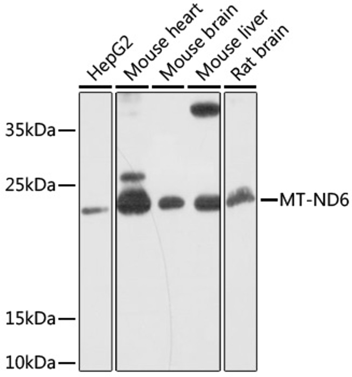 Western blot analysis of extracts of various cell lines, using MT-ND6 antibody (18-182) at 1:1000 dilution.<br/>Secondary antibody: HRP Goat Anti-Rabbit IgG (H+L) at 1:10000 dilution.<br/>Lysates/proteins: 25ug per lane.<br/>Blocking buffer: 3% nonfat dry milk in TBST.<br/>Detection: ECL Basic Kit.<br/>Exposure time: 90s.