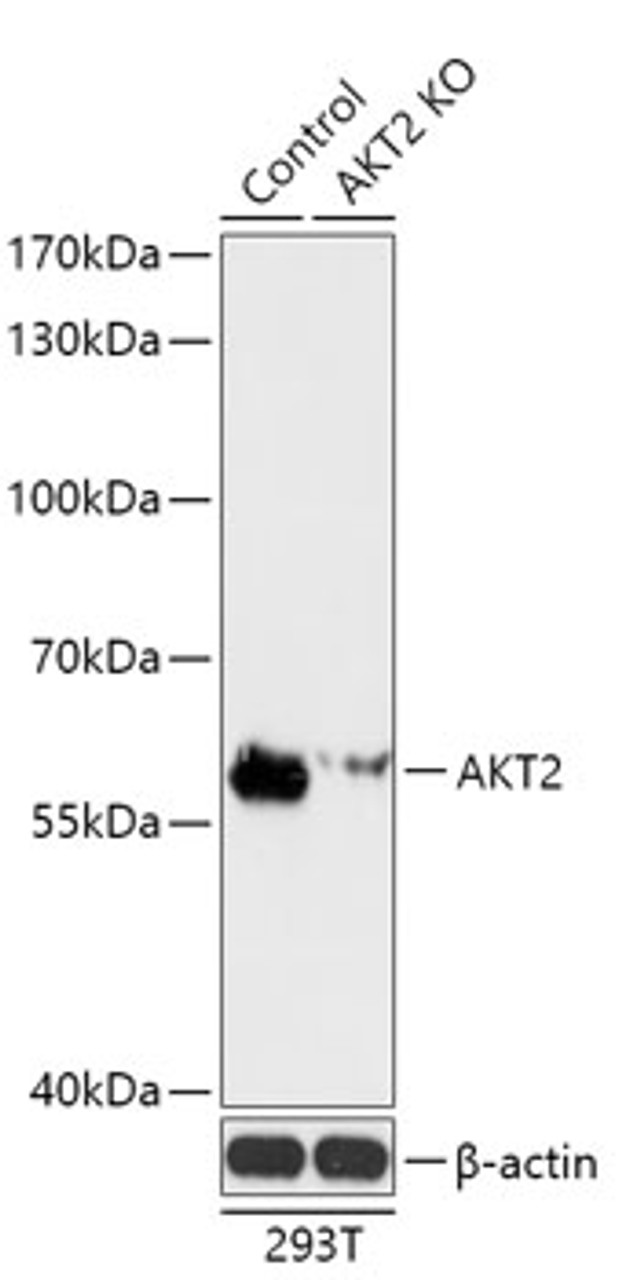Western blot analysis of extracts from normal (control) and AKT2 knockout (KO) 293T cells, using AKT2 antibody (18-206) at 1:3000 dilution.<br/>Secondary antibody: HRP Goat Anti-Rabbit IgG (H+L) at 1:10000 dilution.<br/>Lysates/proteins: 25ug per lane.<br/>Blocking buffer: 3% nonfat dry milk in TBST.<br/>Detection: ECL Basic Kit.<br/>Exposure time: 90s.
