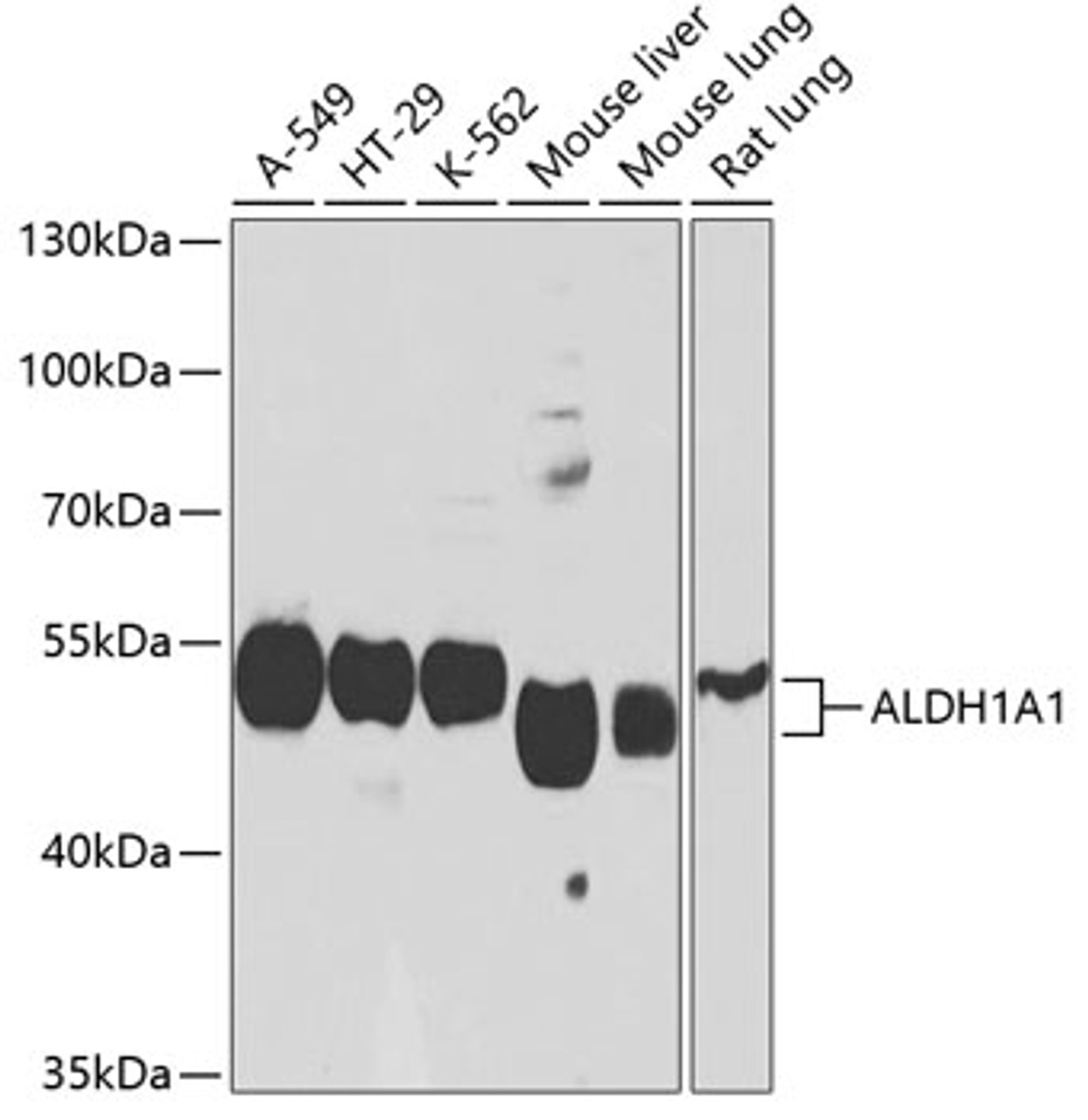 Western blot analysis of extracts of various cell lines, using ALDH1A1 antibody (18-207) at 1:1000 dilution.<br/>Secondary antibody: HRP Goat Anti-Rabbit IgG (H+L) at 1:10000 dilution.<br/>Lysates/proteins: 25ug per lane.<br/>Blocking buffer: 3% nonfat dry milk in TBST.<br/>Detection: ECL Basic Kit.<br/>Exposure time: 20s.