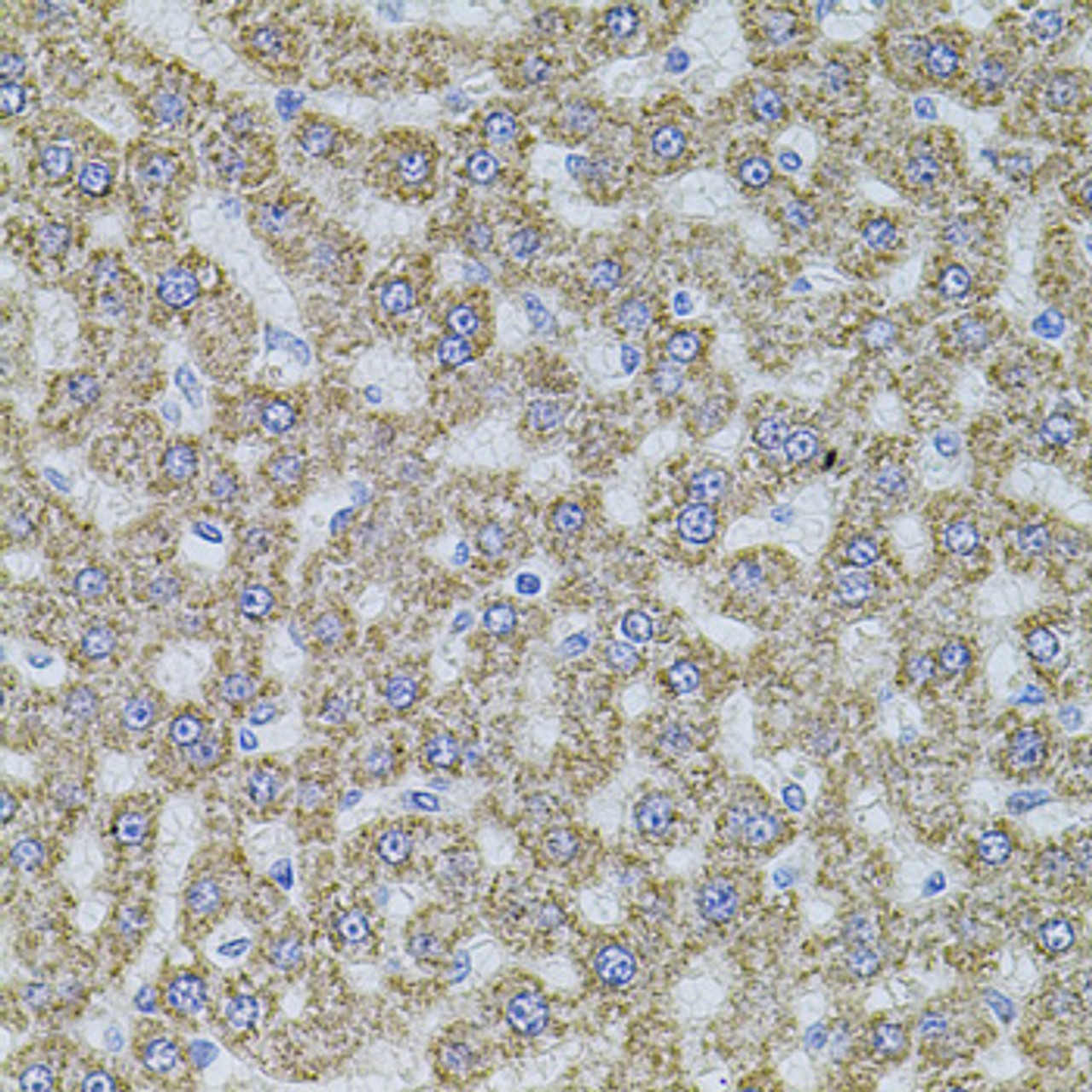 Immunohistochemistry of paraffin-embedded rat liver using ALDH1A1 antibody (18-207) at dilution of 1:100 (40x lens) .