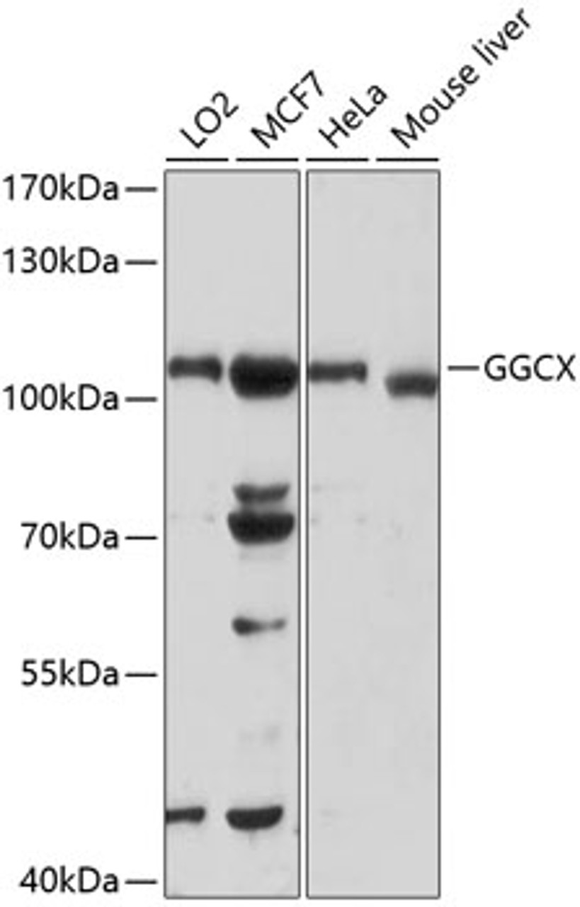 Western blot analysis of extracts of various cell lines, using GGCX antibody (18-249) at 1:1000 dilution.<br/>Secondary antibody: HRP Goat Anti-Rabbit IgG (H+L) at 1:10000 dilution.<br/>Lysates/proteins: 25ug per lane.<br/>Blocking buffer: 3% nonfat dry milk in TBST.<br/>Detection: ECL Basic Kit.<br/>Exposure time: 90s.