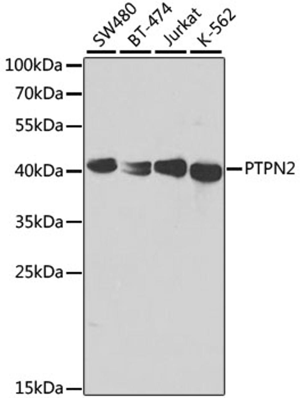 Western blot analysis of extracts of various cell lines, using PTPN2 antibody (18-270) at 1:1000 dilution.<br/>Secondary antibody: HRP Goat Anti-Rabbit IgG (H+L) at 1:10000 dilution.<br/>Lysates/proteins: 25ug per lane.<br/>Blocking buffer: 3% nonfat dry milk in TBST.<br/>Detection: ECL Basic Kit.