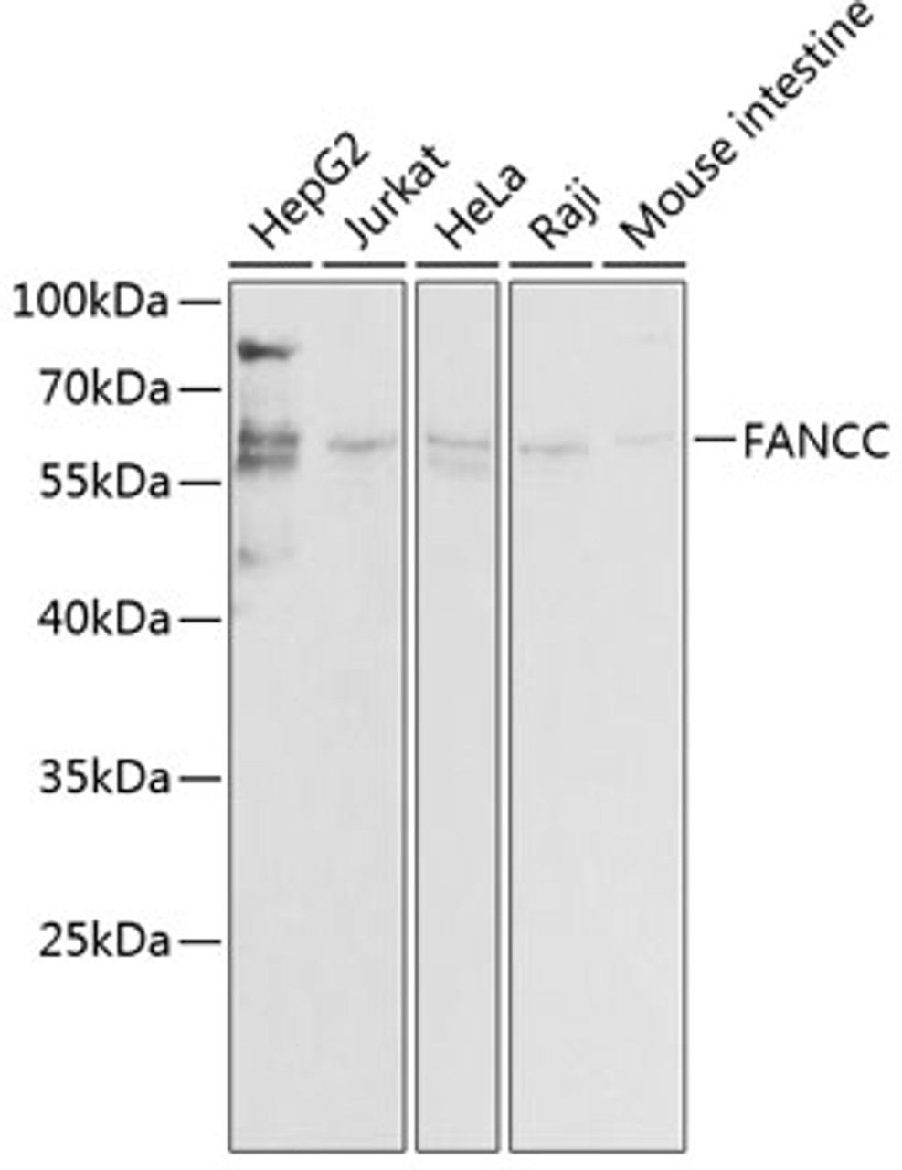 Western blot analysis of extracts of various cell lines, using FANCC antibody (18-299) at 1:1000 dilution.<br/>Secondary antibody: HRP Goat Anti-Rabbit IgG (H+L) at 1:10000 dilution.<br/>Lysates/proteins: 25ug per lane.<br/>Blocking buffer: 3% nonfat dry milk in TBST.