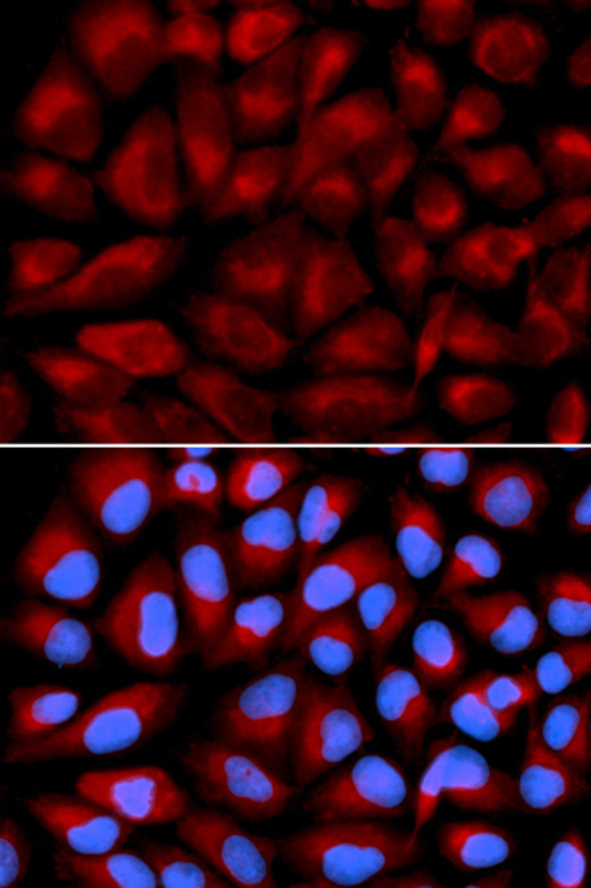 Immunofluorescence analysis of U2OS cells using FANCC antibody (18-299) . Blue: DAPI for nuclear staining.