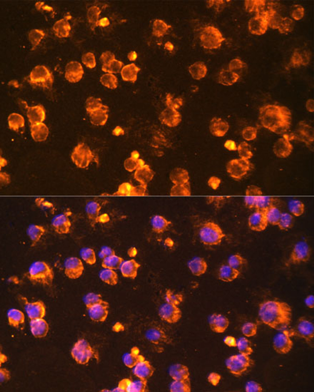 Immunofluorescence analysis of Jurkat cells using FYN Polyclonal Antibody (18-302) at dilution of 1:100 (40x lens) . Blue: DAPI for nuclear staining.