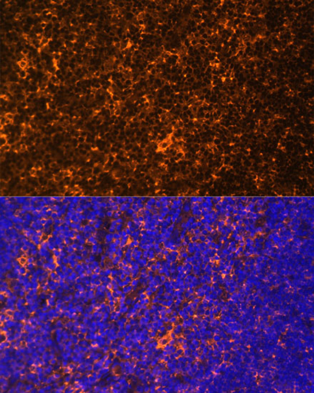 Immunofluorescence analysis of rat thymus using FYN Polyclonal Antibody (18-302) at dilution of 1:100 (40x lens) . Blue: DAPI for nuclear staining.