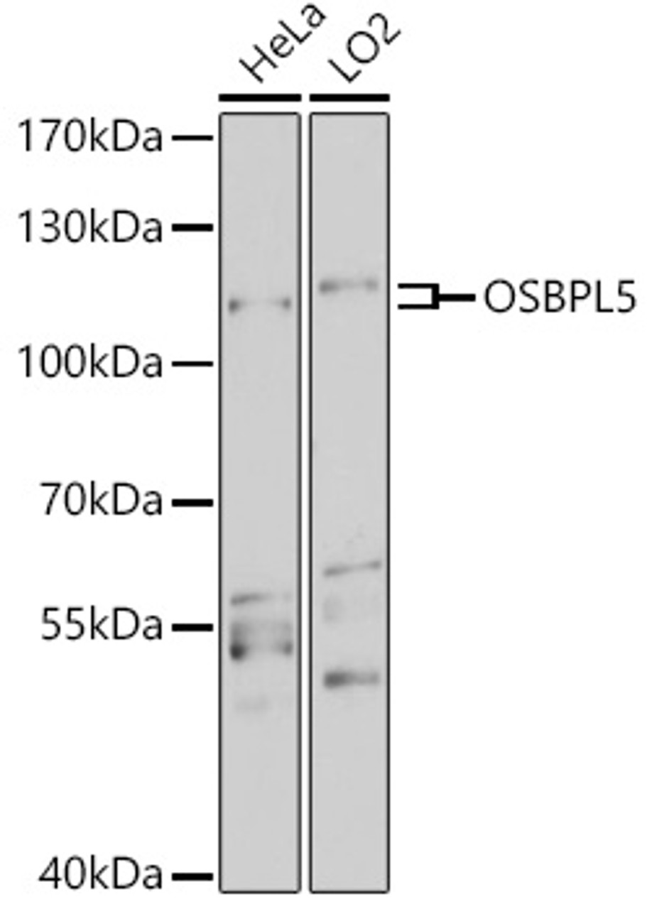 Western blot analysis of extracts of various cell lines, using OSBPL5 antibody (18-307) at 1:3000 dilution.<br/>Secondary antibody: HRP Goat Anti-Rabbit IgG (H+L) at 1:10000 dilution.<br/>Lysates/proteins: 25ug per lane.<br/>Blocking buffer: 3% nonfat dry milk in TBST.<br/>Detection: ECL Basic Kit.<br/>Exposure time: 90s.