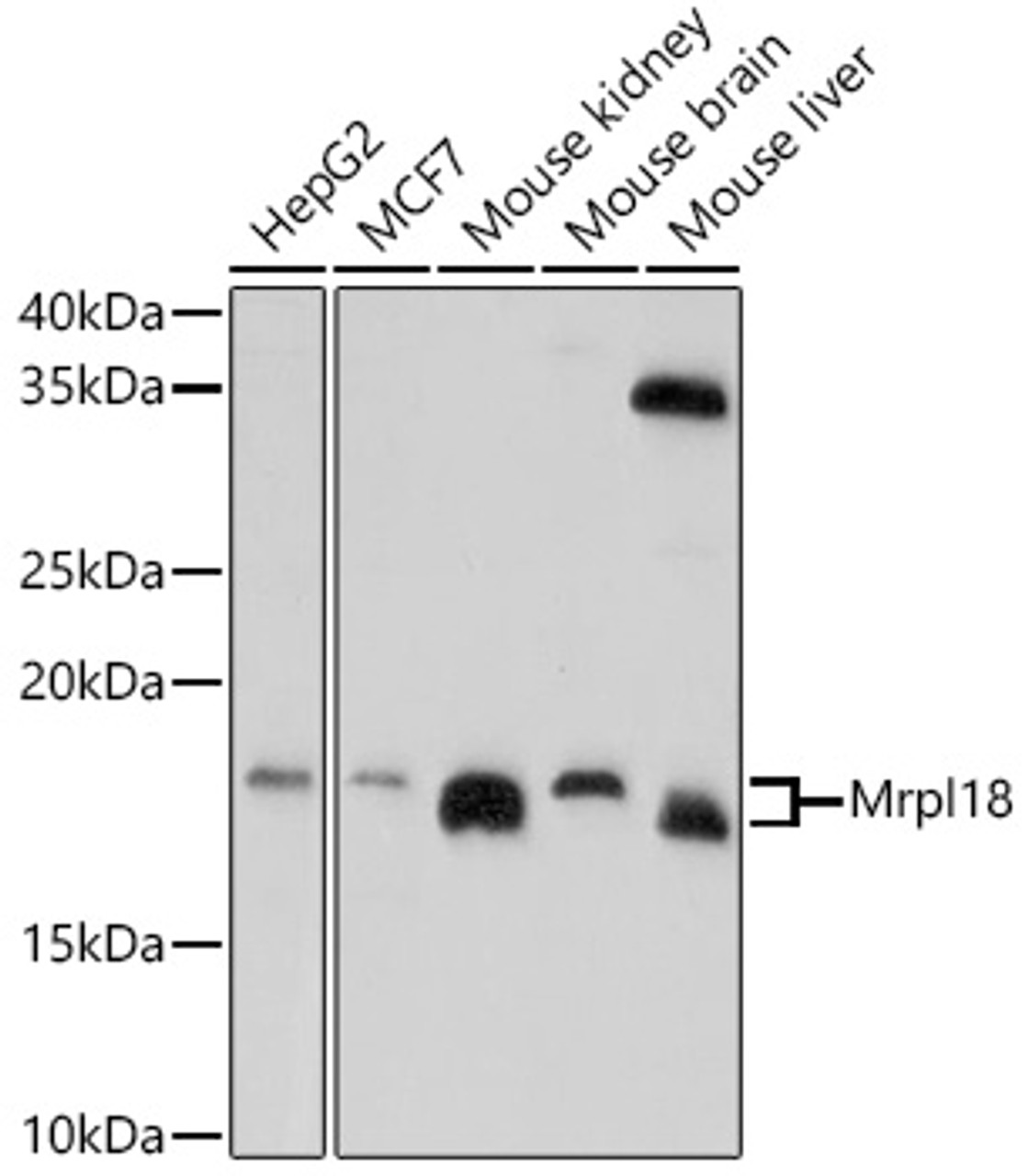 Western blot analysis of extracts of various cell lines, using Mrpl18 antibody (18-317) at 1:1000 dilution.<br/>Secondary antibody: HRP Goat Anti-Rabbit IgG (H+L) at 1:10000 dilution.<br/>Lysates/proteins: 25ug per lane.<br/>Blocking buffer: 3% nonfat dry milk in TBST.<br/>Detection: ECL Enhanced Kit.<br/>Exposure time: 180s.