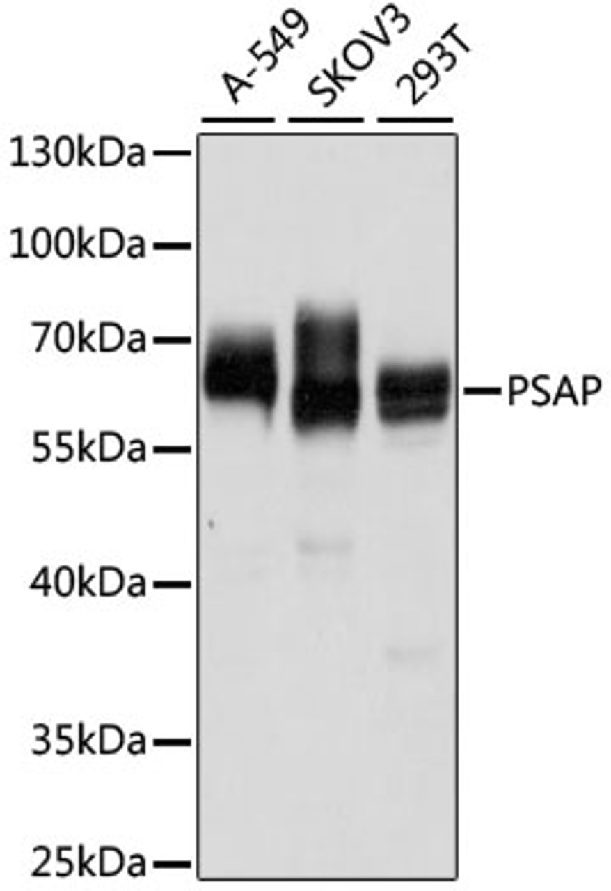 Western blot analysis of extracts of various cell lines, using PSAP antibody (18-320) at 1:1000 dilution.<br/>Secondary antibody: HRP Goat Anti-Rabbit IgG (H+L) at 1:10000 dilution.<br/>Lysates/proteins: 25ug per lane.<br/>Blocking buffer: 3% nonfat dry milk in TBST.<br/>Detection: ECL Enhanced Kit.<br/>Exposure time: 5s.