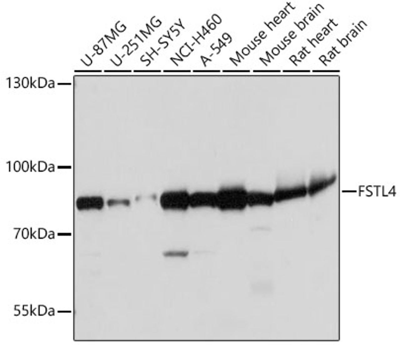 Western blot analysis of extracts of various cell lines, using FSTL4 antibody (18-325) at 1:1000 dilution.<br/>Secondary antibody: HRP Goat Anti-Rabbit IgG (H+L) at 1:10000 dilution.<br/>Lysates/proteins: 25ug per lane.<br/>Blocking buffer: 3% nonfat dry milk in TBST.<br/>Detection: ECL Basic Kit.<br/>Exposure time: 2s.