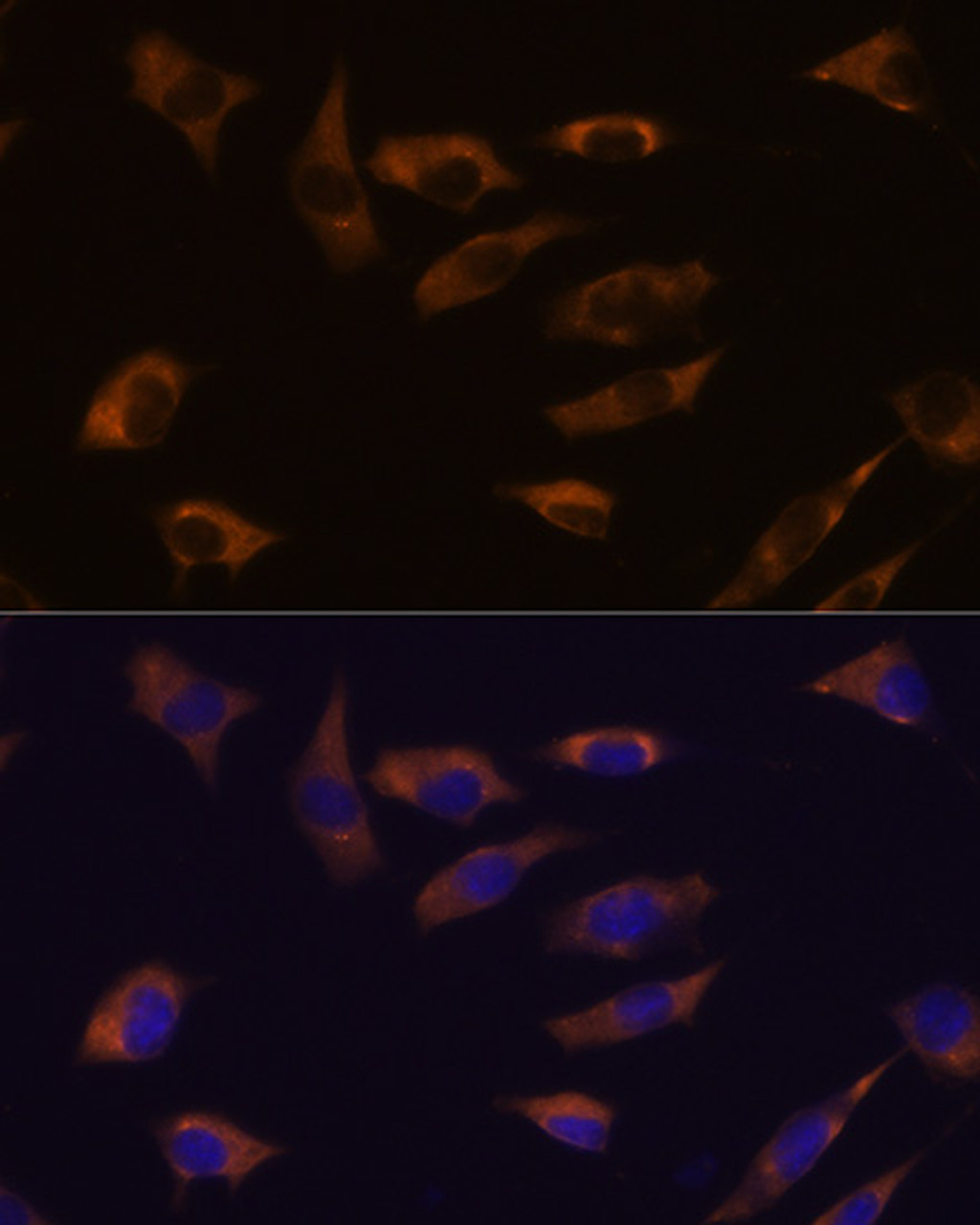 Immunofluorescence analysis of L929 cells using FSTL4 antibody (18-325) at dilution of 1:100. Blue: DAPI for nuclear staining.