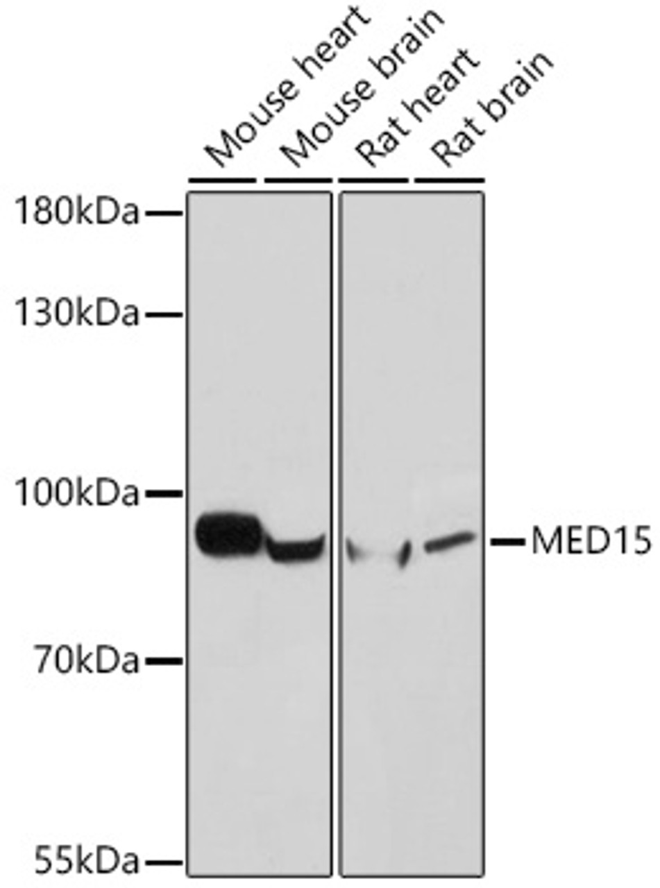 Western blot analysis of extracts of various cell lines, using MED15 antibody (18-326) at 1:1000 dilution.<br/>Secondary antibody: HRP Goat Anti-Rabbit IgG (H+L) at 1:10000 dilution.<br/>Lysates/proteins: 25ug per lane.<br/>Blocking buffer: 3% nonfat dry milk in TBST.<br/>Detection: ECL Basic Kit.<br/>Exposure time: 10s.