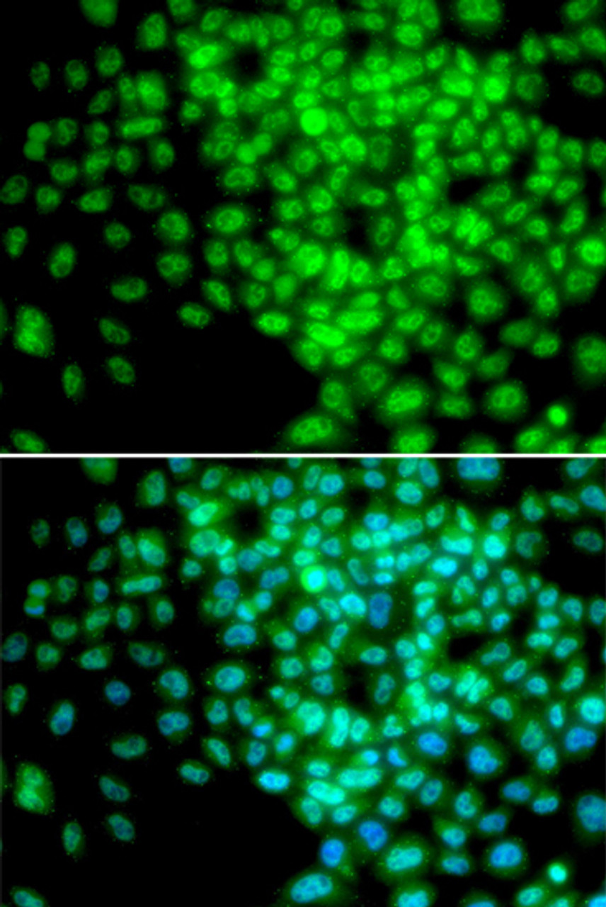 Immunofluorescence analysis of HeLa cells using POLR2F antibody (18-328) . Blue: DAPI for nuclear staining.