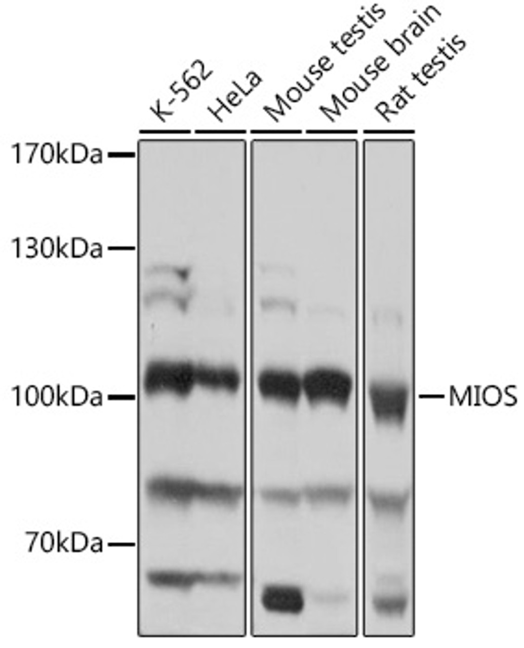 Western blot analysis of extracts of various cell lines, using MIOS antibody (18-332) at 1:1000 dilution.<br/>Secondary antibody: HRP Goat Anti-Rabbit IgG (H+L) at 1:10000 dilution.<br/>Lysates/proteins: 25ug per lane.<br/>Blocking buffer: 3% nonfat dry milk in TBST.<br/>Detection: ECL Basic Kit.<br/>Exposure time: 1s.