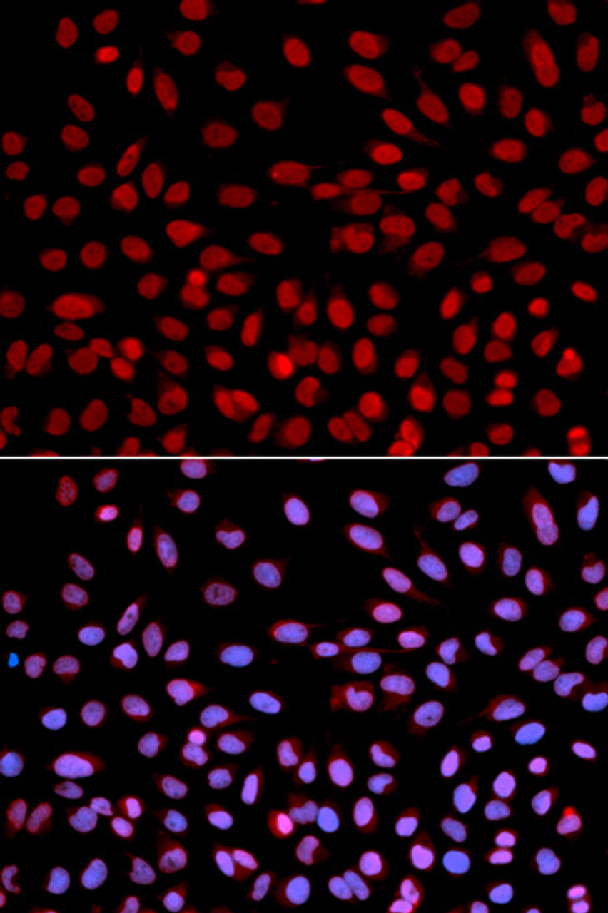 Immunofluorescence analysis of U2OS cells using DNA polymerase eta antibody (18-337) . Blue: DAPI for nuclear staining.